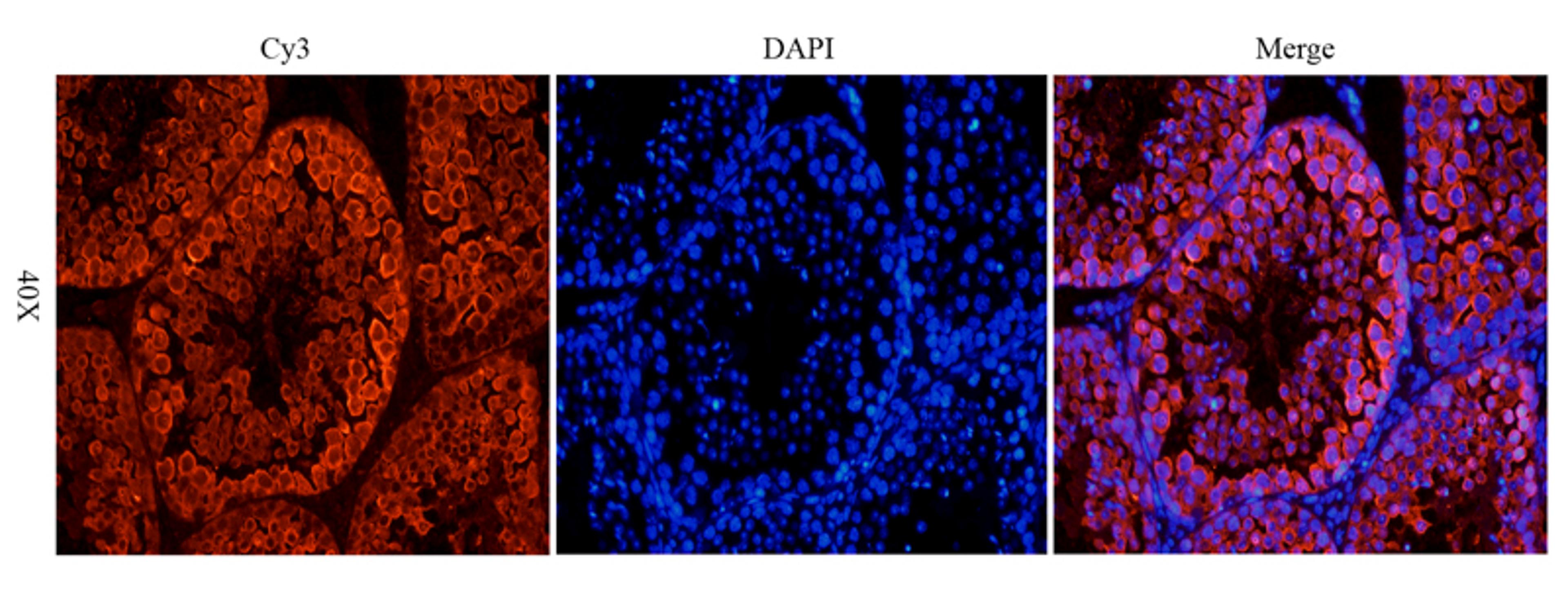 IF analysis of mouse testis tissue using Stathmin antibody (dilution of primary antibody at 1:100)