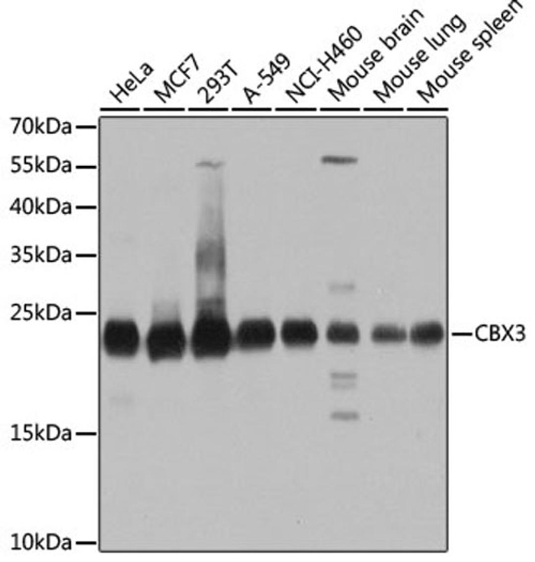 Western blot - CBX3 antibody (A2248)