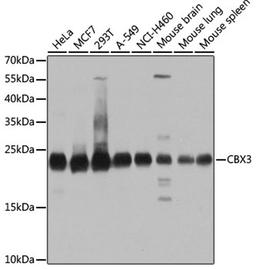 Western blot - CBX3 antibody (A2248)