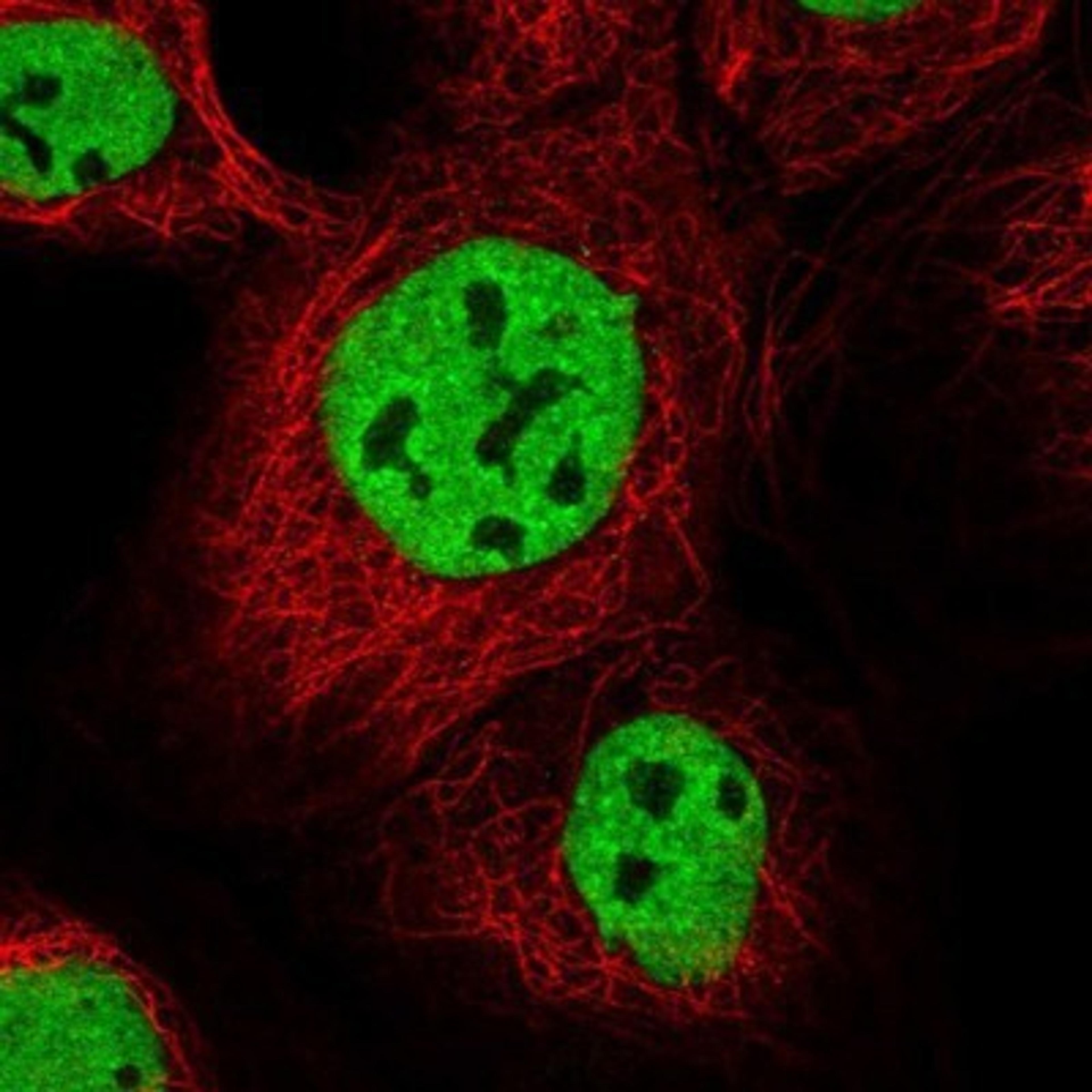 Immunocytochemistry/Immunofluorescence: IBTK Antibody [NBP1-88512] - Staining of human cell line A-431 shows positivity in nuclei but not nucleoli.