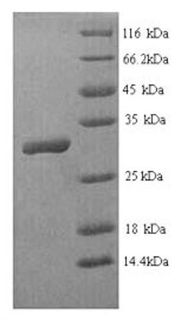 (Tris-Glycine gel) Discontinuous SDS-PAGE (reduced) with 5% enrichment gel and 15% separation gel.