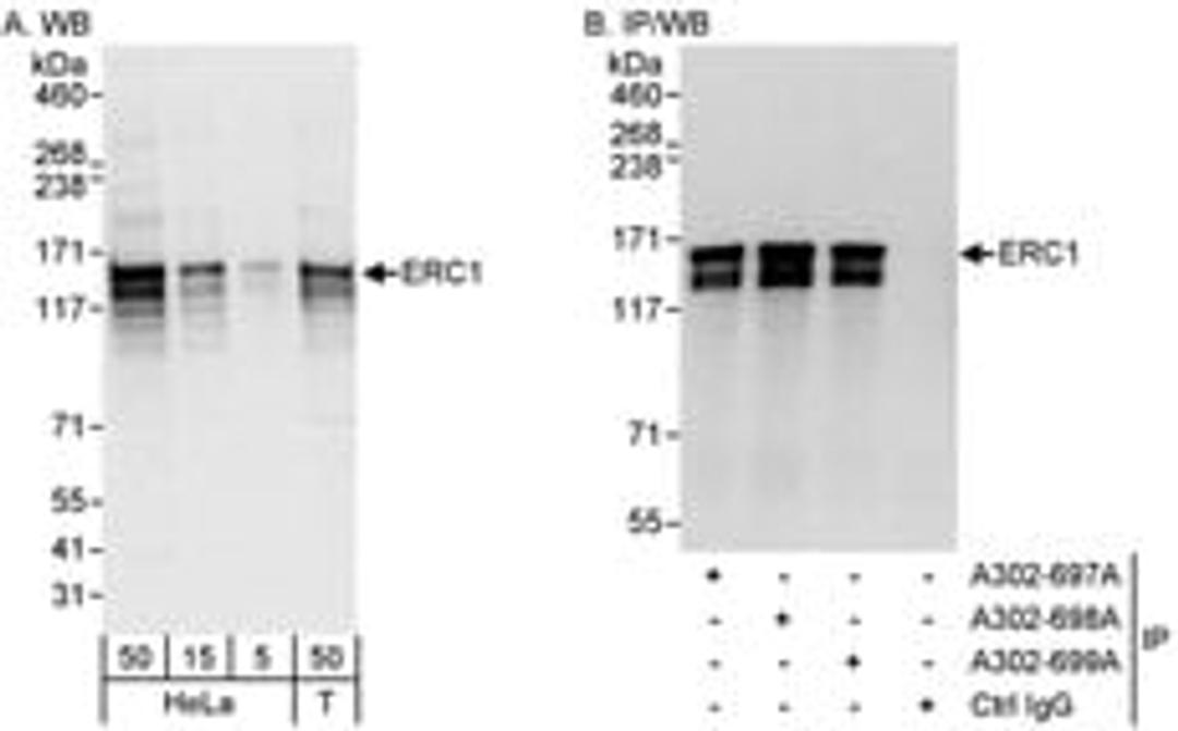 Detection of human ERC1 by western blot and immunoprecipitation.