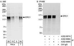 Detection of human ERC1 by western blot and immunoprecipitation.