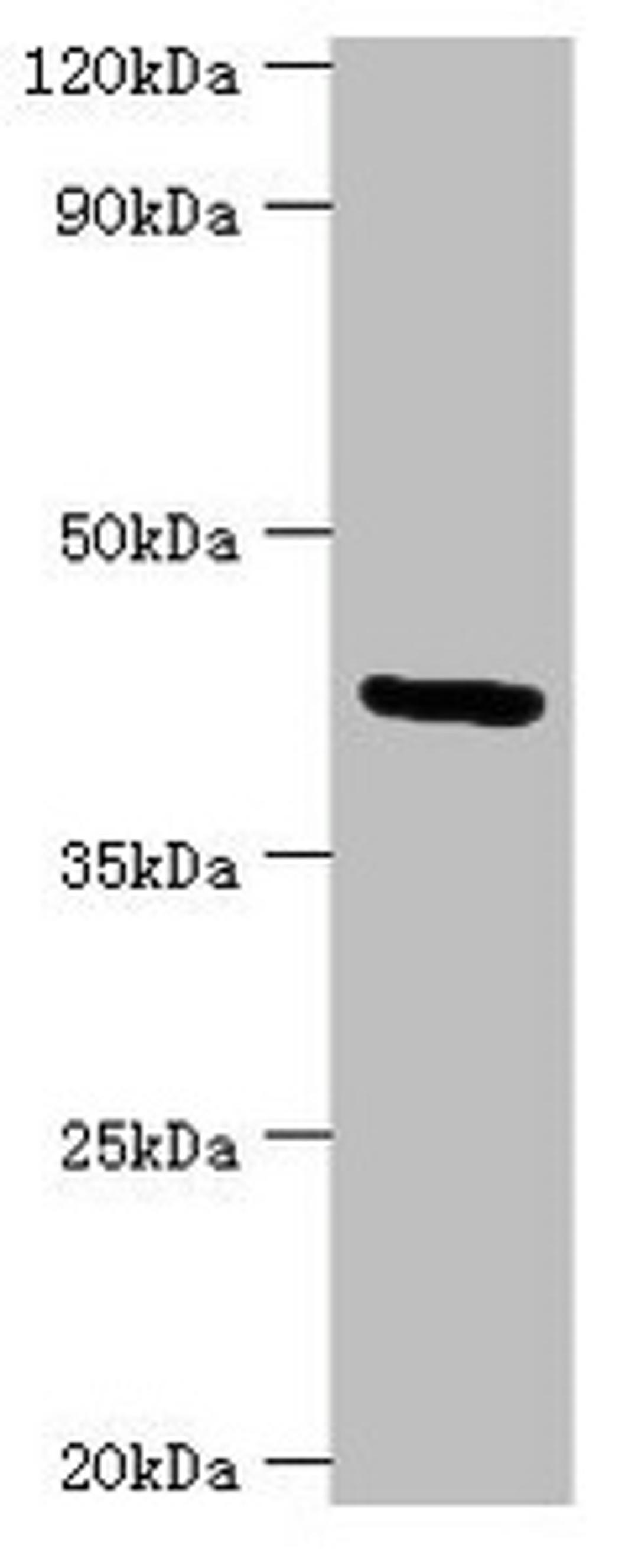 Western blot. All lanes: Golgi membrane protein 1 antibody at 7ug/ml + Hela whole cell lysate. Secondary. Goat polyclonal to rabbit IgG at 1/10000 dilution. Predicted band size: 46, 45 kDa. Observed band size: 46 kDa. 