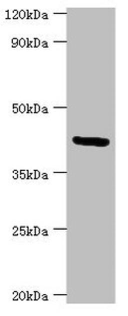 Western blot. All lanes: Golgi membrane protein 1 antibody at 7ug/ml + Hela whole cell lysate. Secondary. Goat polyclonal to rabbit IgG at 1/10000 dilution. Predicted band size: 46, 45 kDa. Observed band size: 46 kDa. 