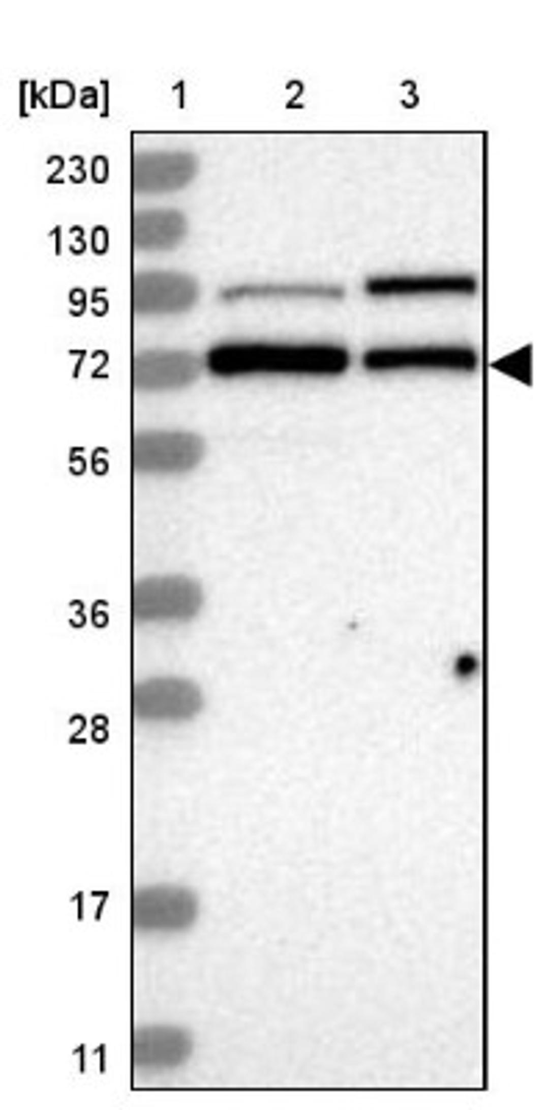 Western Blot: DBR1 Antibody [NBP1-85907] - Lane 1: Marker [kDa] 230, 130, 95, 72, 56, 36, 28, 17, 11<br/>Lane 2: Human cell line RT-4<br/>Lane 3: Human cell line U-251MG sp