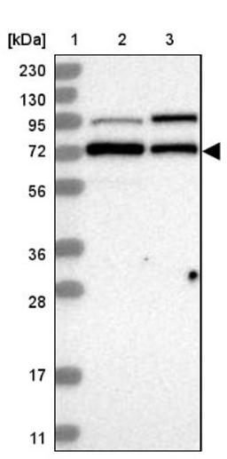 Western Blot: DBR1 Antibody [NBP1-85907] - Lane 1: Marker [kDa] 230, 130, 95, 72, 56, 36, 28, 17, 11<br/>Lane 2: Human cell line RT-4<br/>Lane 3: Human cell line U-251MG sp