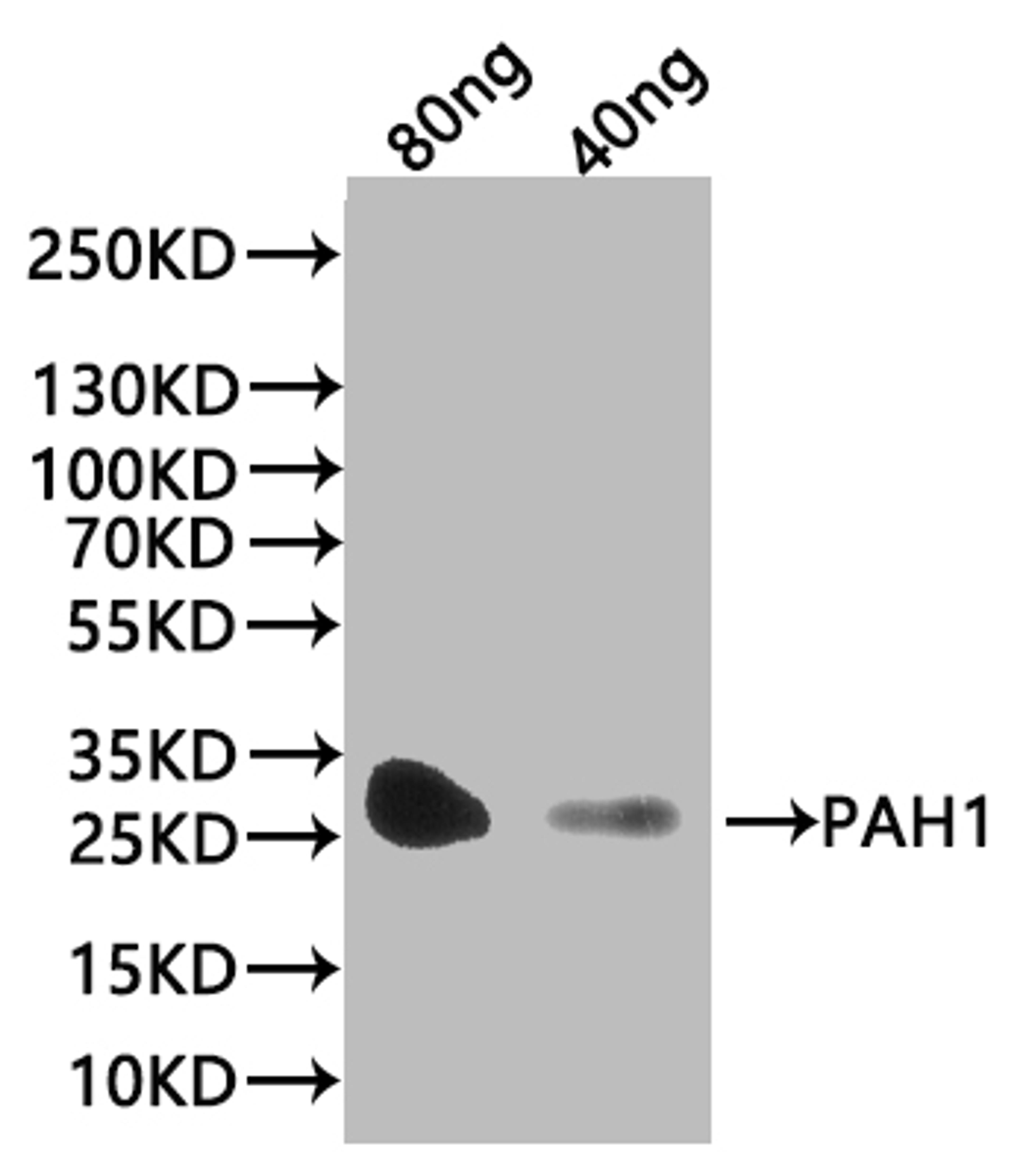 Western Blot. Positive WB detected in: recombinant protein. All lanes:PAH1 Antibody at 1:1000. Secondary. Goat polyclonal to rabbit IgG at 1/20000 dilution. Predicted band size: 30.4 kDa. Observed band size: 30 kDa.