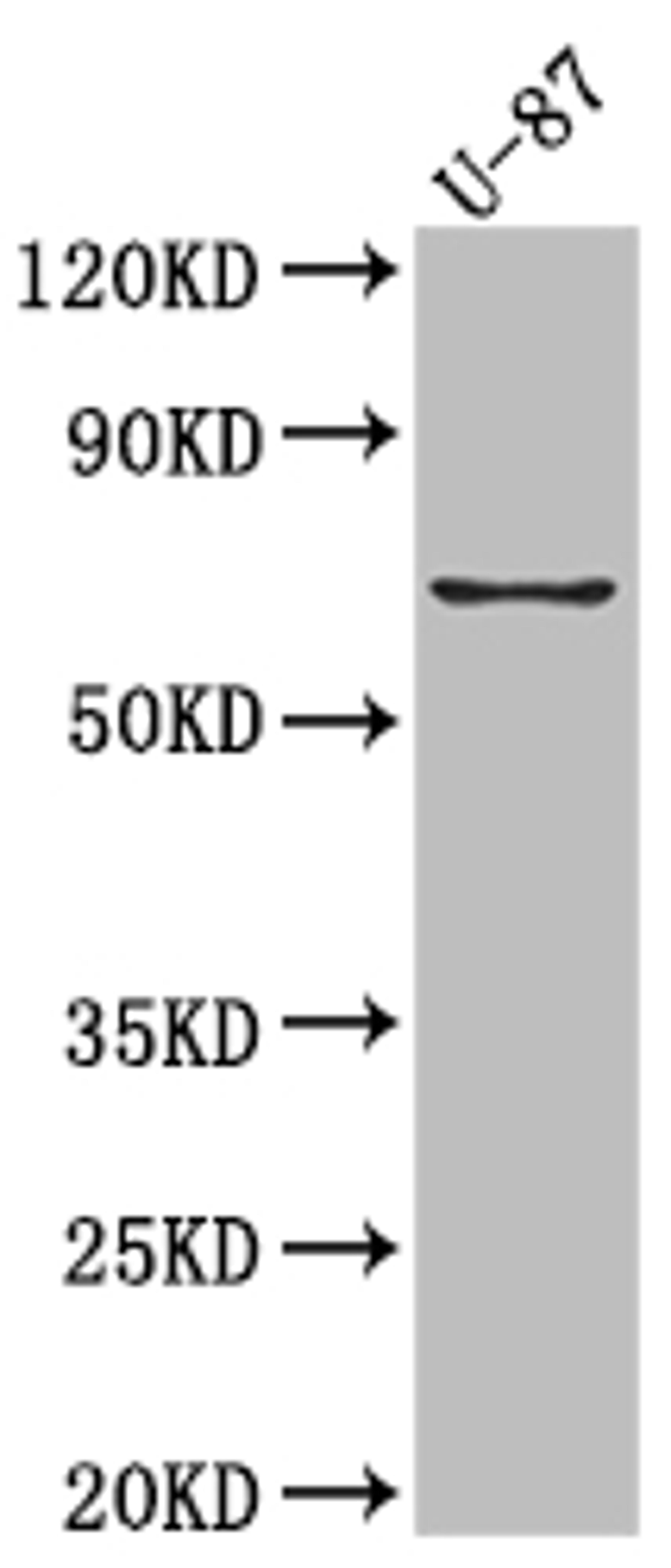 Western Blot. Positive WB detected in: U-87 whole cell lysate. All lanes: COX2 Antibody at 1:1000. Secondary. Goat polyclonal to rabbit IgG at 1/50000 dilution. Predicted band size: 69 kDa. Observed band size: 69 kDa.