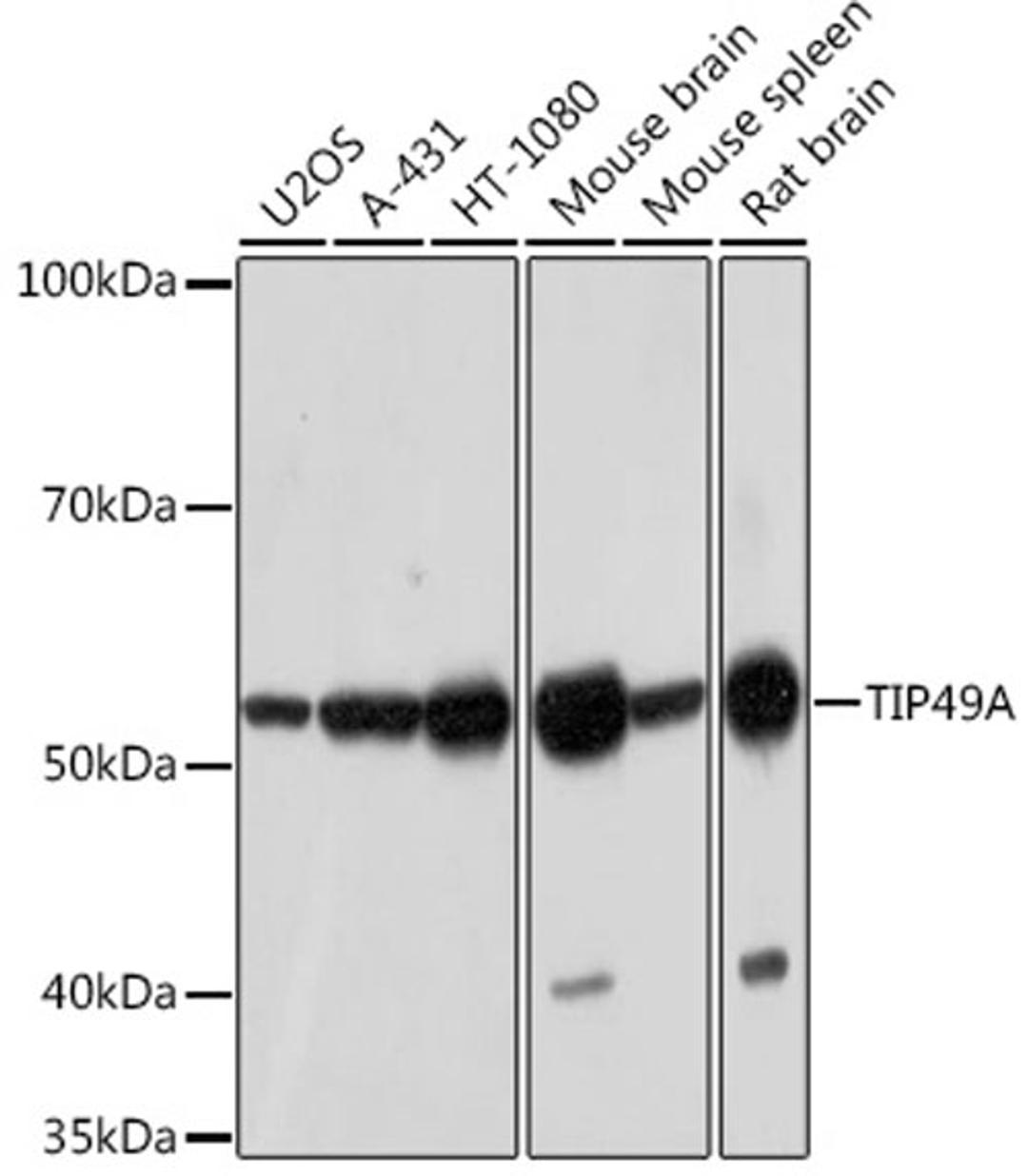 Western blot - TIP49A Rabbit mAb (A5180)