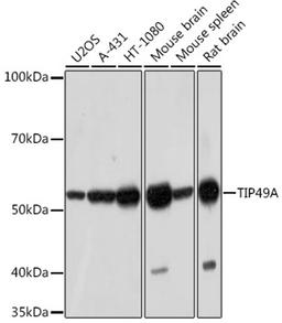 Western blot - TIP49A Rabbit mAb (A5180)