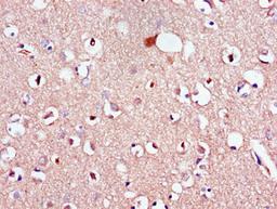 Immunohistochemistry of paraffin-embedded human brain tissue using CSB-PA013047LA01HU at dilution of 1:100