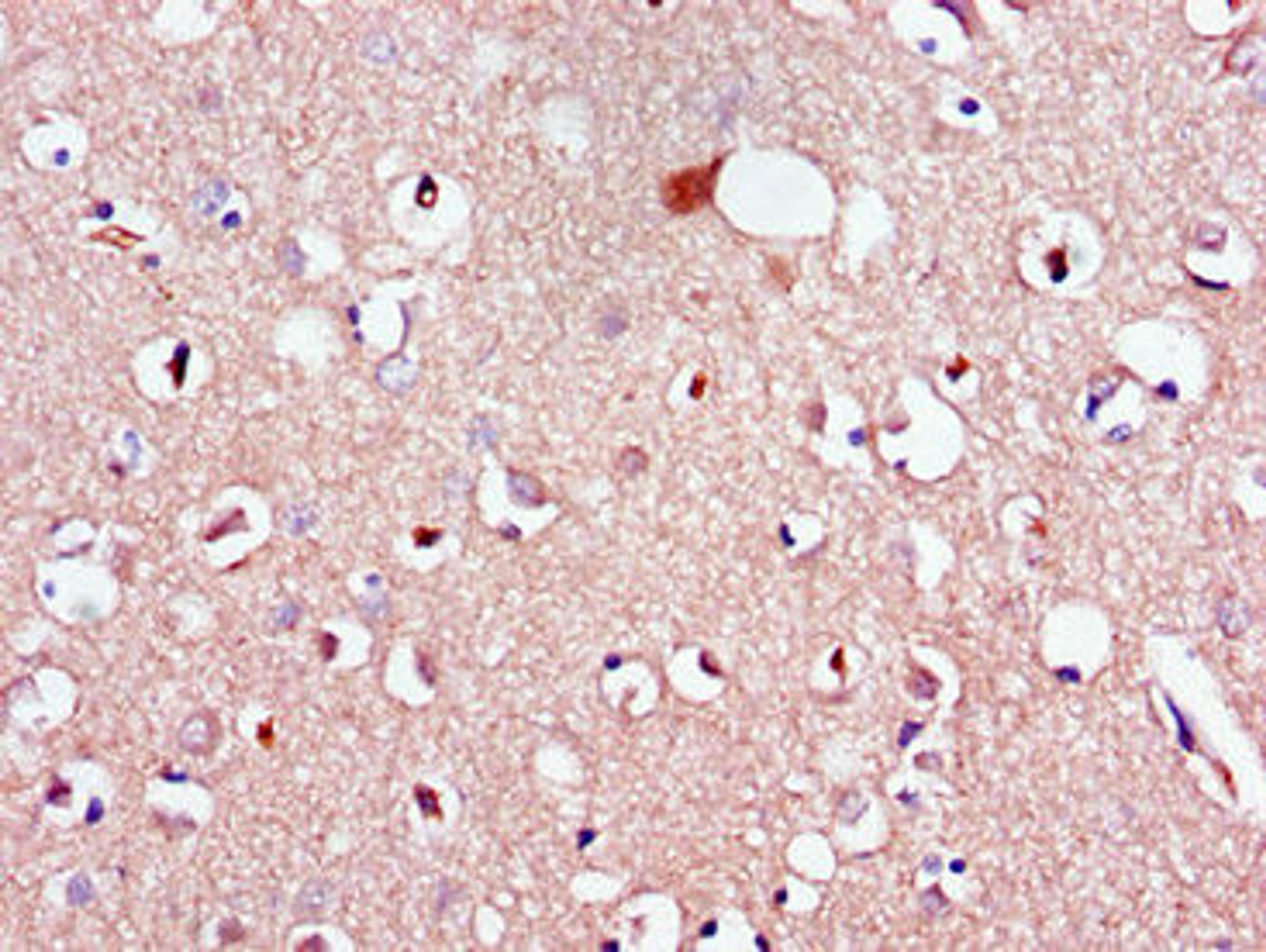 Immunohistochemistry of paraffin-embedded human brain tissue using CSB-PA013047LA01HU at dilution of 1:100