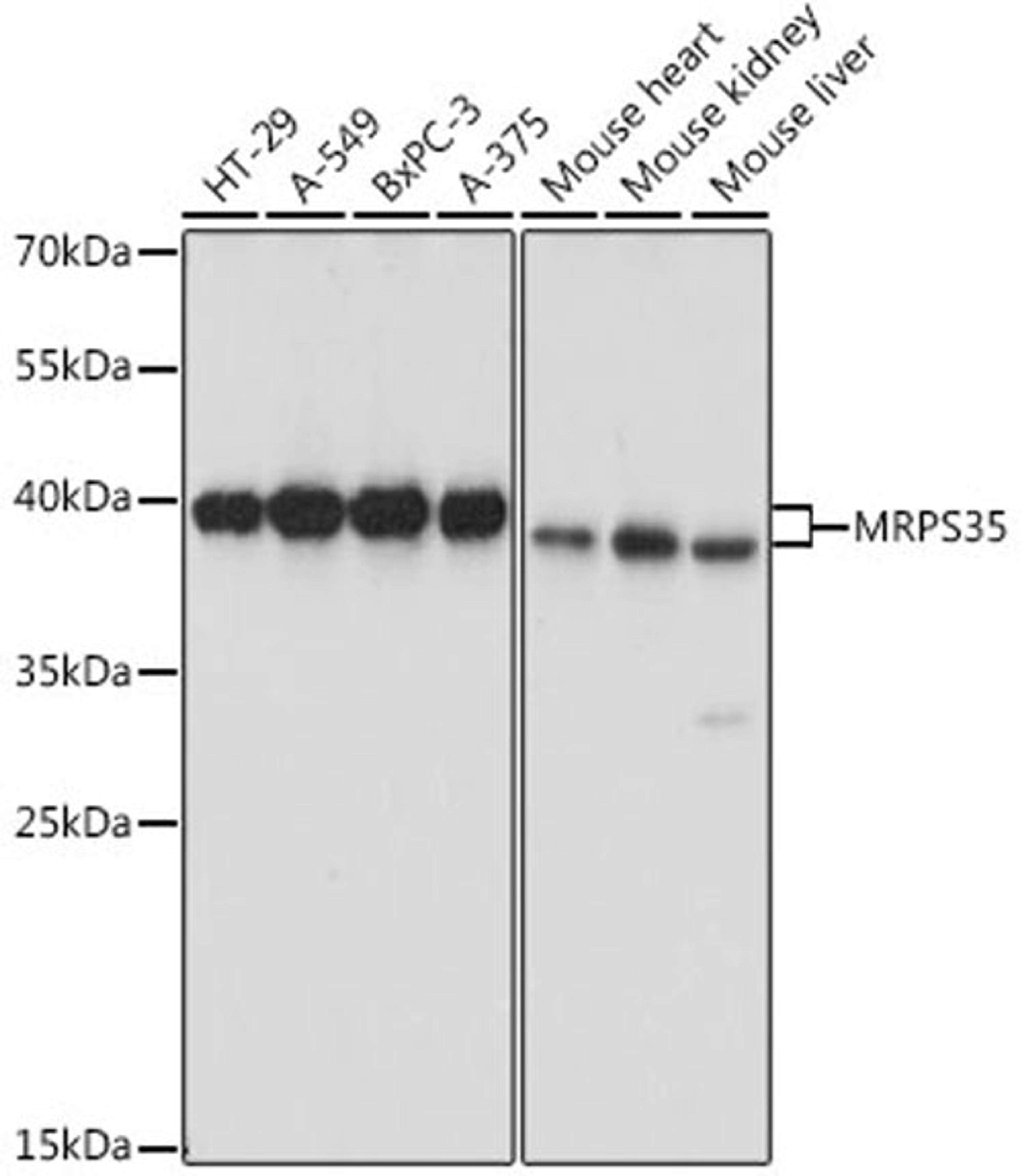 Western blot - MRPS35 antibody (A15878)