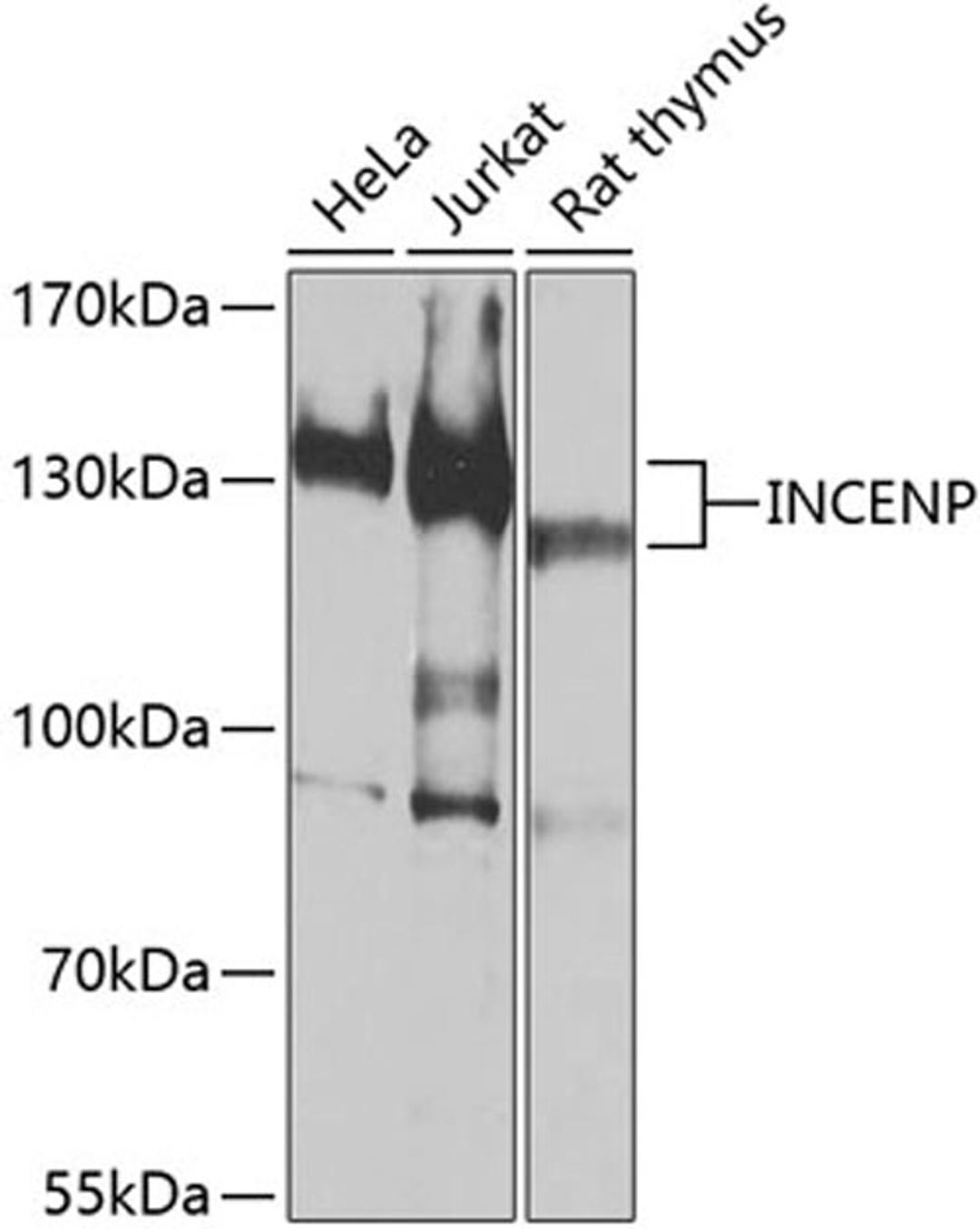 Western blot - INCENP antibody (A0622)