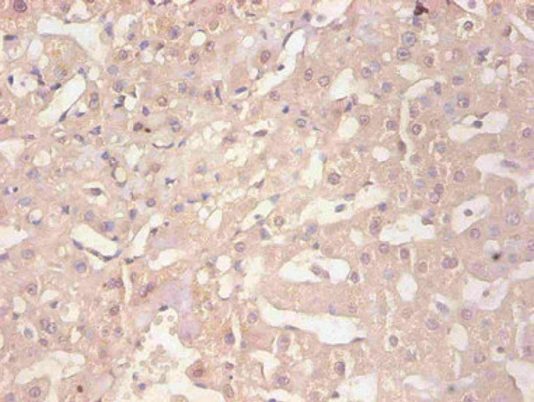Immunohistochemical of paraffin-embedded human liver tissue using CSB-MA114091A0m at dilution of 1:200