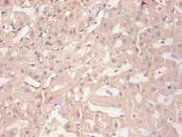 Immunohistochemical of paraffin-embedded human liver tissue using CSB-MA114091A0m at dilution of 1:200