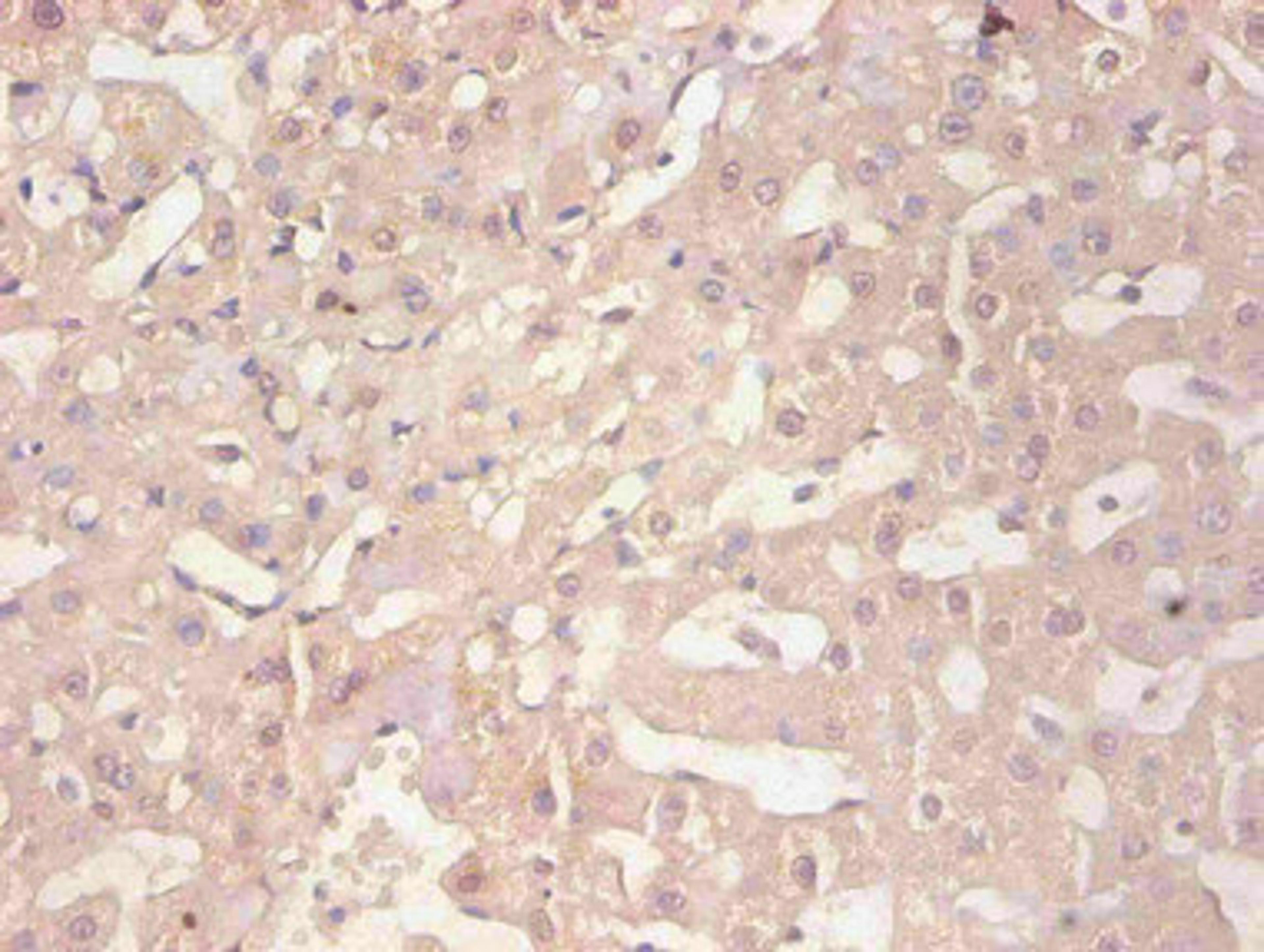 Immunohistochemical of paraffin-embedded human liver tissue using CSB-MA114091A0m at dilution of 1:200