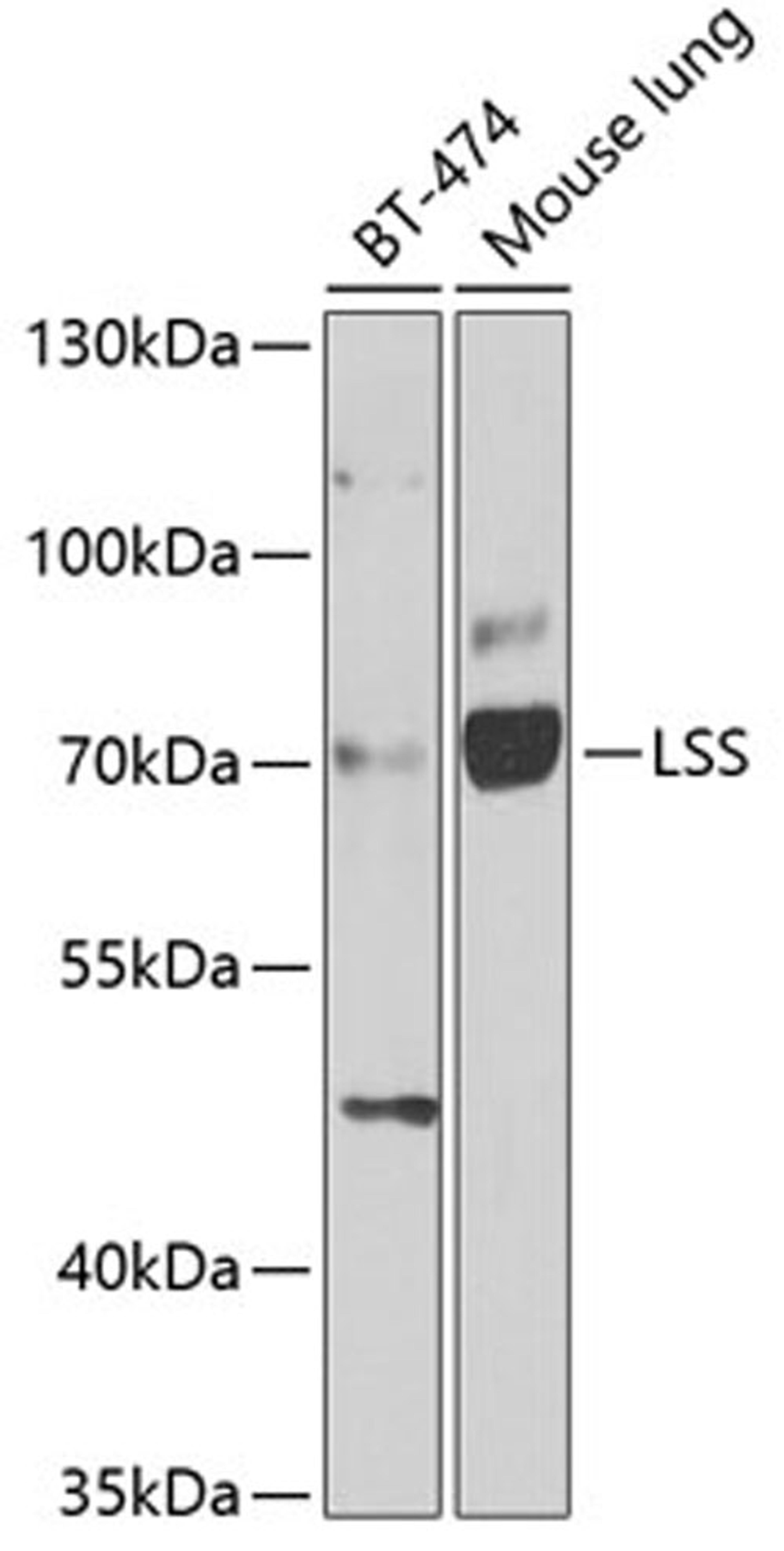 Western blot - LSS antibody (A6930)