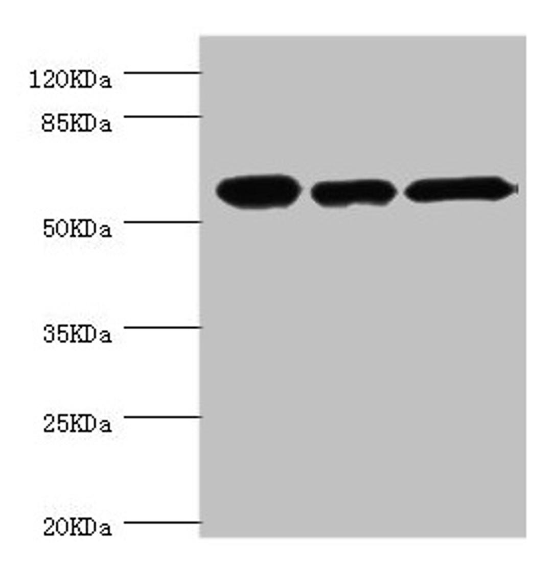 Western blot. All lanes: CCT2 antibody at 5.63ug/ml. Lane 1: Jurkat whole cell lysate. Lane 2: NIH/3T3 whole cell lysate. Lane 3: MCF-7 whole cell lysate. Secondary. Goat polyclonal to rabbit IgG at 1/10000 dilution. Predicted band size: 58, 53 kDa. Observed band size: 58 kDa.
