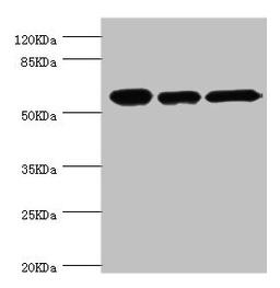 Western blot. All lanes: CCT2 antibody at 5.63ug/ml. Lane 1: Jurkat whole cell lysate. Lane 2: NIH/3T3 whole cell lysate. Lane 3: MCF-7 whole cell lysate. Secondary. Goat polyclonal to rabbit IgG at 1/10000 dilution. Predicted band size: 58, 53 kDa. Observed band size: 58 kDa.