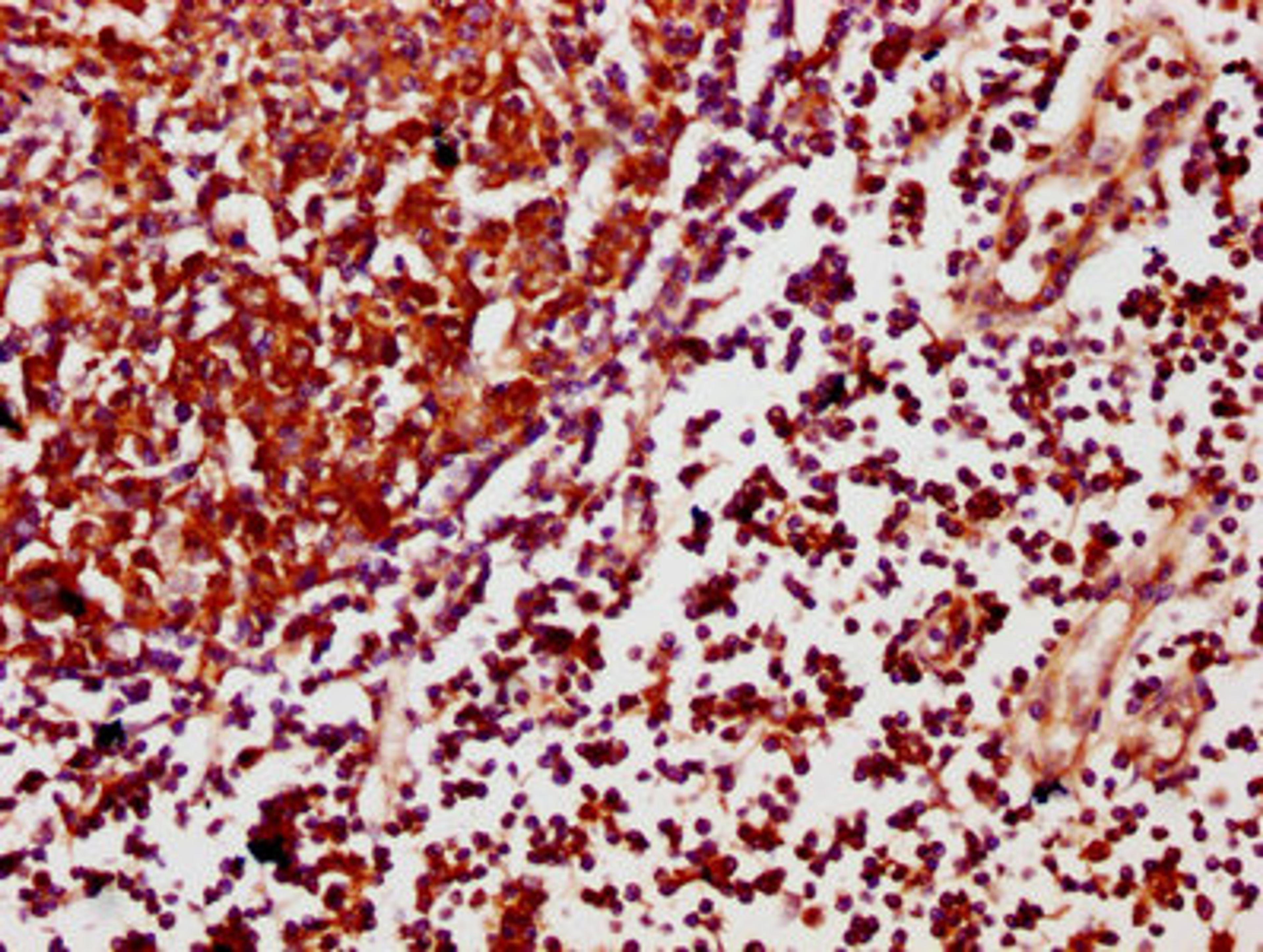 IHC image of CSB-PA754405LA01HU diluted at 1:500 and staining in paraffin-embedded human lymph node tissue performed on a Leica BondTM system. After dewaxing and hydration, antigen retrieval was mediated by high pressure in a citrate buffer (pH 6.0). Section was blocked with 10% normal goat serum 30min at RT. Then primary antibody (1% BSA) was incubated at 4&deg;C overnight. The primary is detected by a biotinylated secondary antibody and visualized using an HRP conjugated SP system.