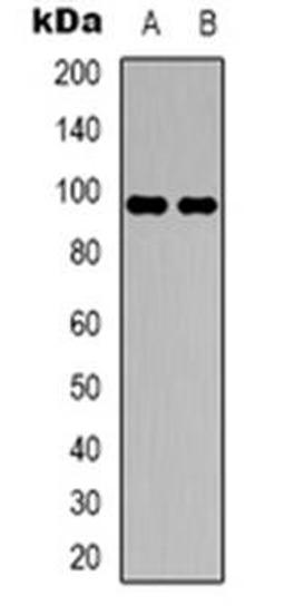 Western blot analysis of DMGDH expression in HepG2 (Lane 1), A549 (Lane 2) whole cell lysates using DMGDH antibody