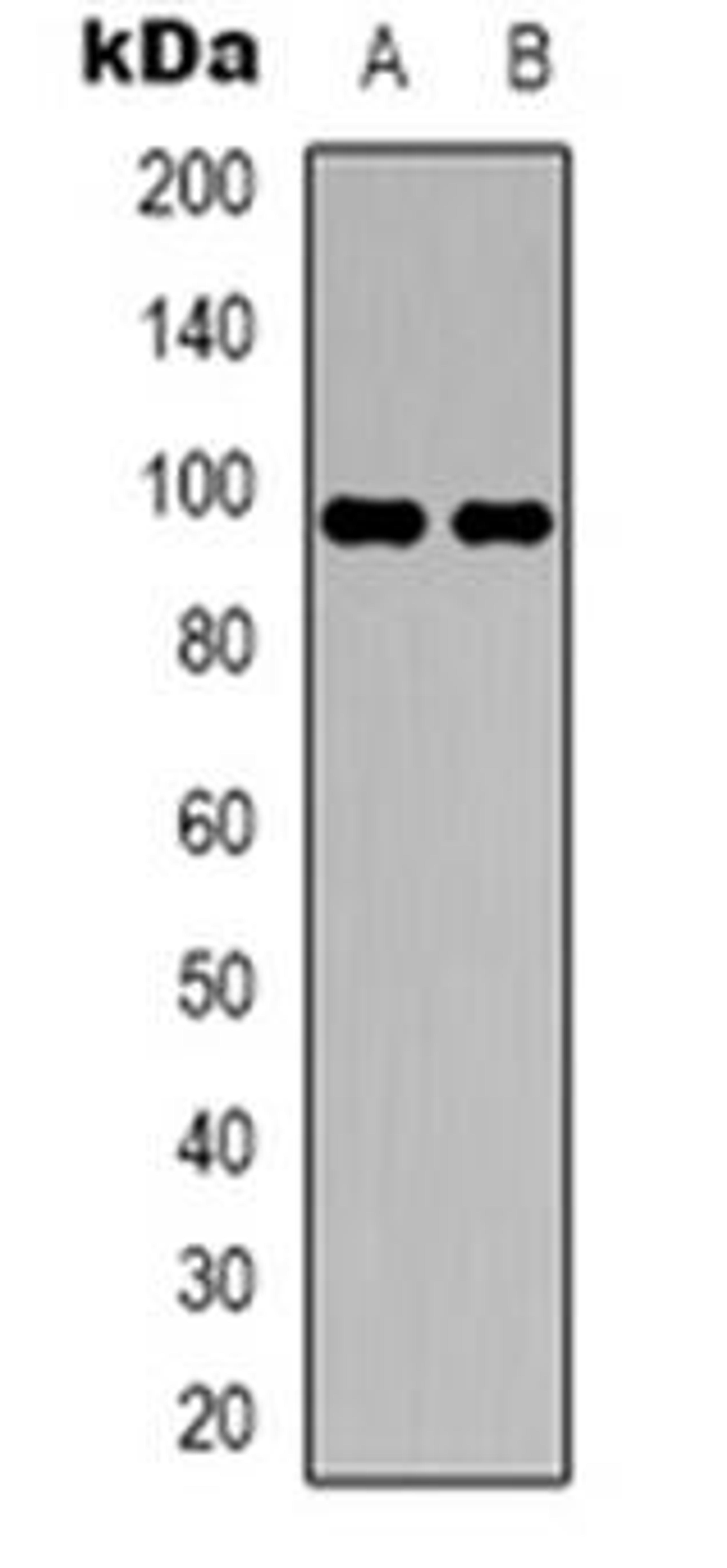 Western blot analysis of DMGDH expression in HepG2 (Lane 1), A549 (Lane 2) whole cell lysates using DMGDH antibody