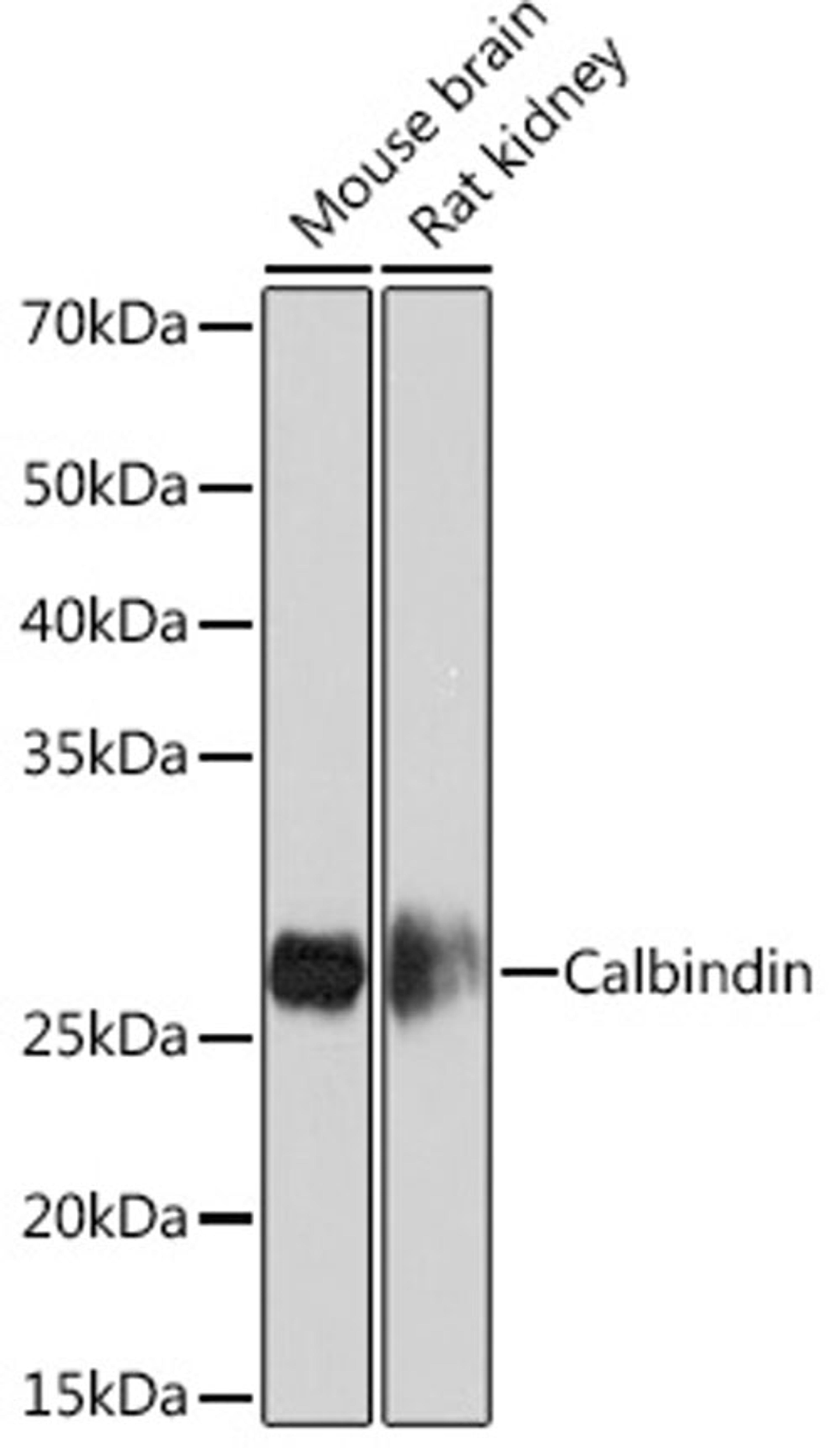 Western blot - Calbindin Rabbit mAb (A4284)