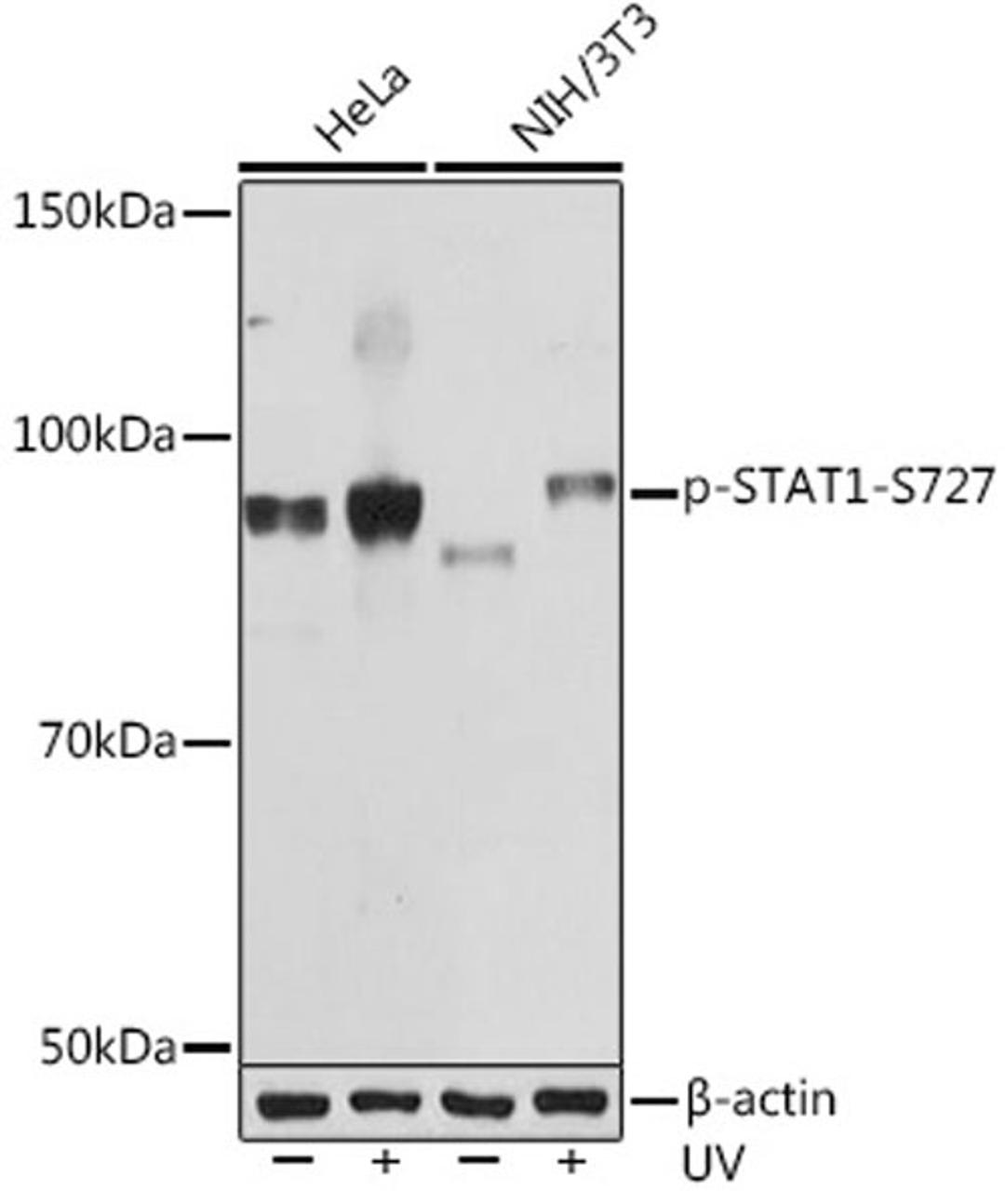 Western blot - Phospho-STAT1-S727 Rabbit mAb (AP1000)