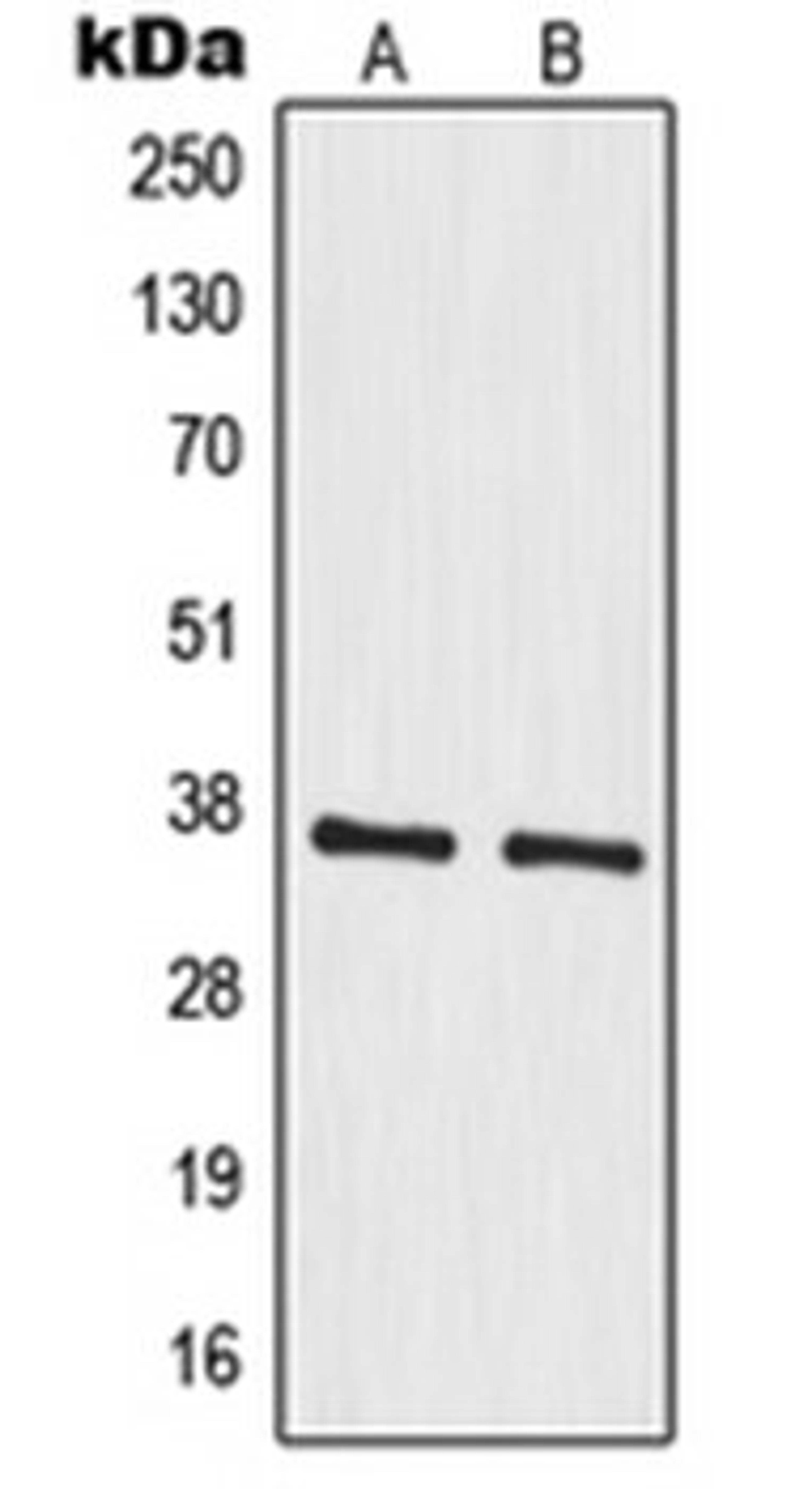 Western blot analysis of A549 (Lane 1), HeLa (Lane 2) whole cell lysates using MRPS35 antibody