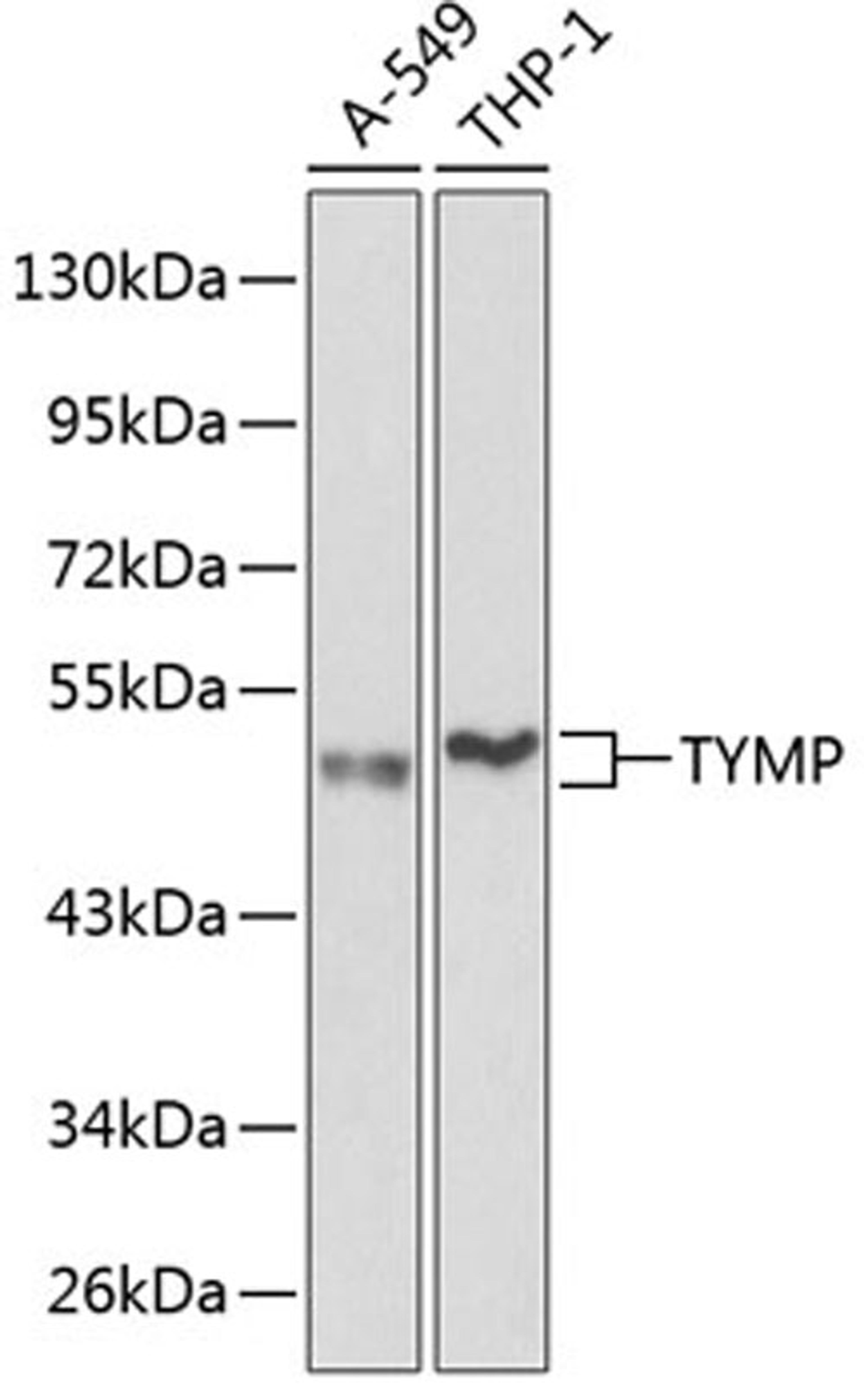 Western blot - TYMP antibody (A1094)