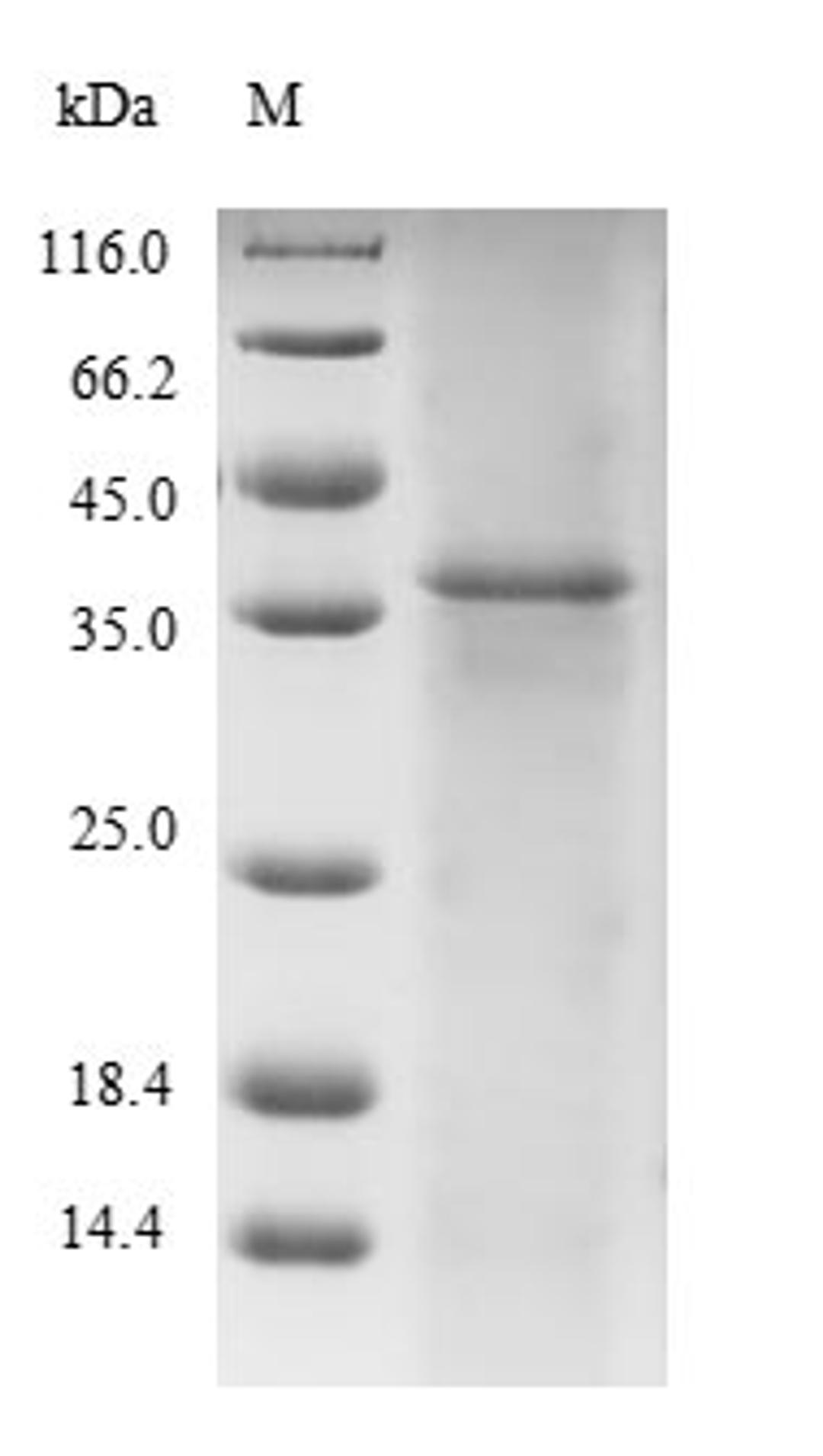 (Tris-Glycine gel) Discontinuous SDS-PAGE (reduced) with 5% enrichment gel and 15% separation gel.