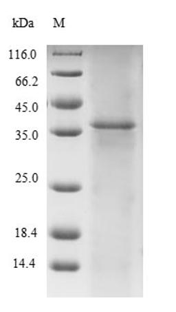 (Tris-Glycine gel) Discontinuous SDS-PAGE (reduced) with 5% enrichment gel and 15% separation gel.