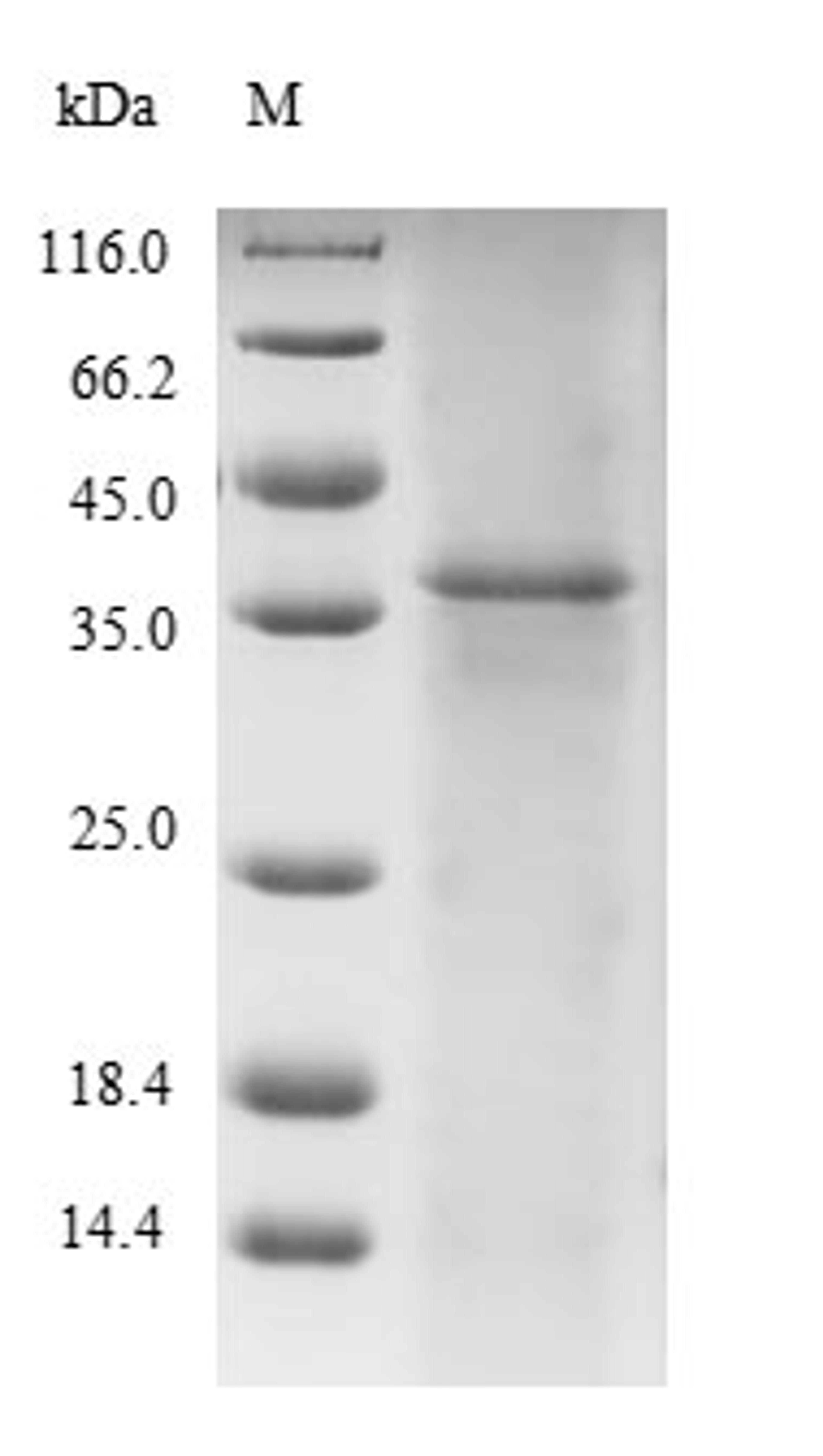 (Tris-Glycine gel) Discontinuous SDS-PAGE (reduced) with 5% enrichment gel and 15% separation gel.