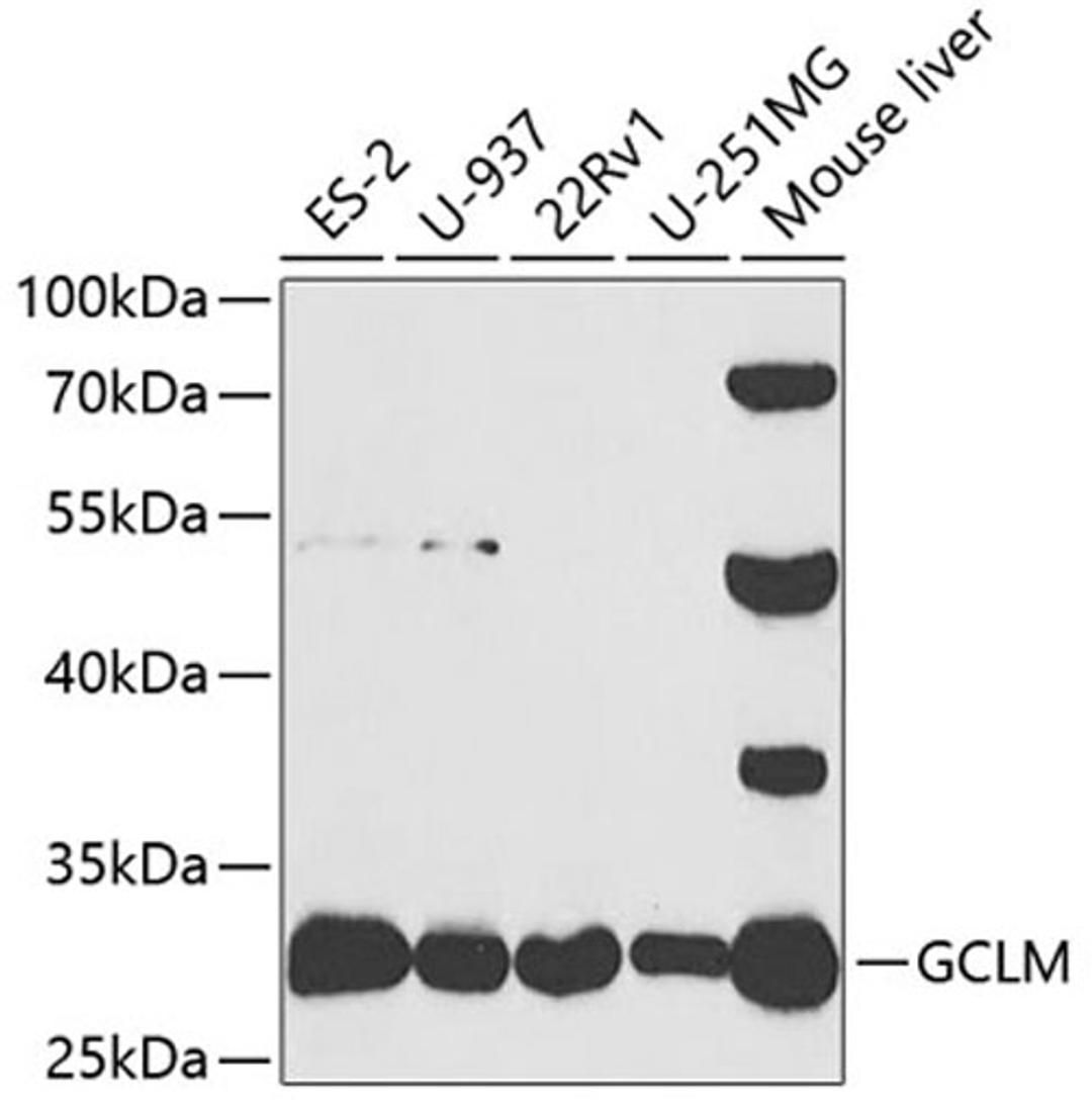 Western blot - GCLM antibody (A5314)