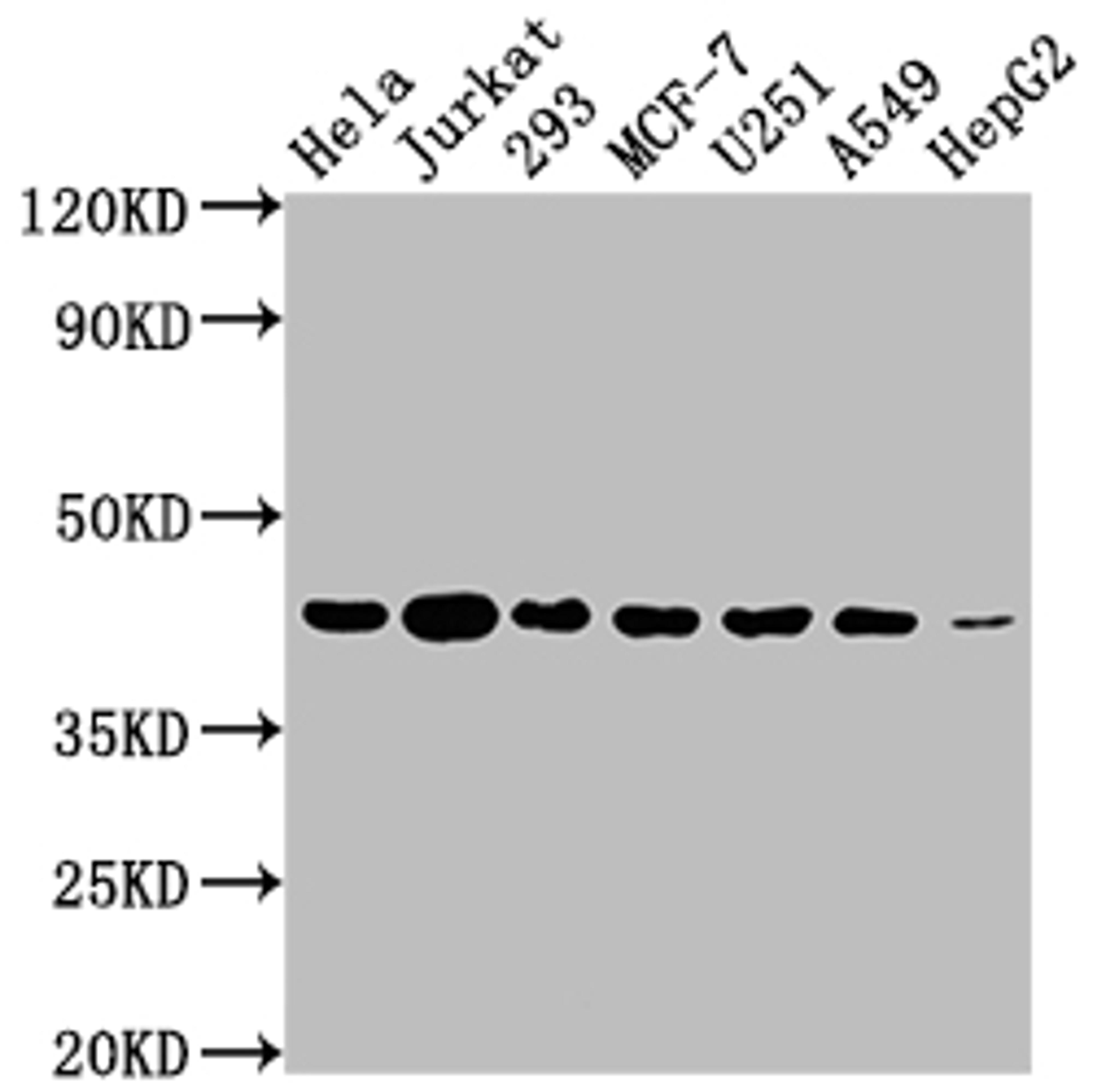 Western Blot. Positive WB detected in: Hela whole cell lysate, Jurkat whole cell lysate, 293 whole cell lysate, MCF-7 whole cell lysate, U251 whole cell lysate, A549 whole cell lysate, HepG2 whole cell lysate. All lanes: AURKB antibody at 1:2000. Secondary. Goat polyclonal to rabbit IgG at 1/50000 dilution. Predicted band size: 40, 36, 17, 35 kDa. Observed band size: 40 kDa. 