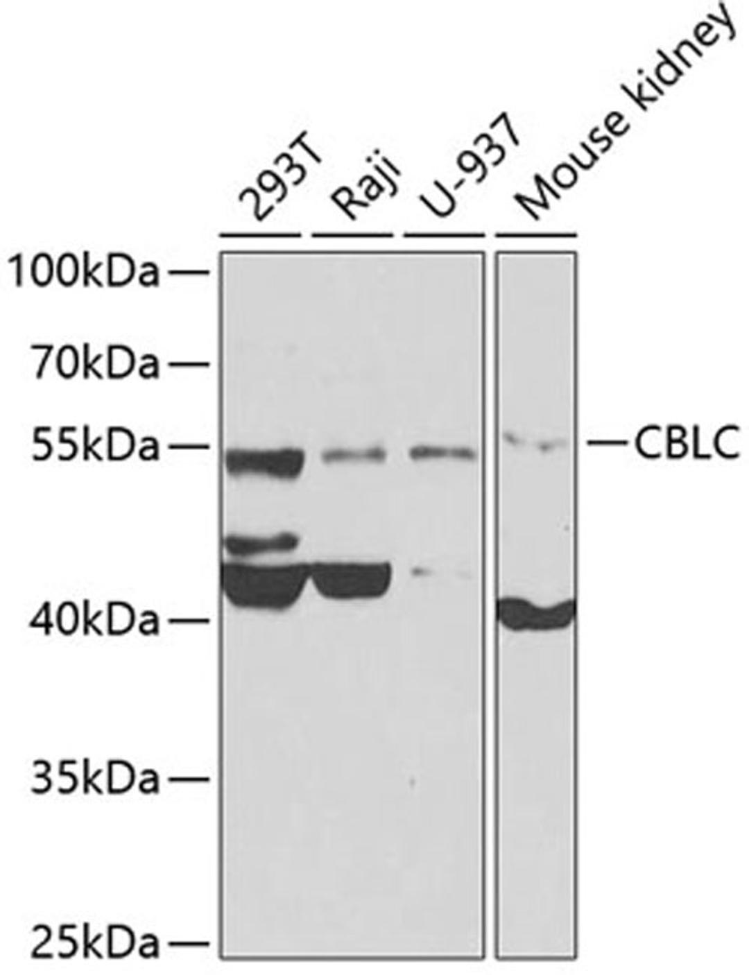 Western blot - CBLC antibody (A7789)