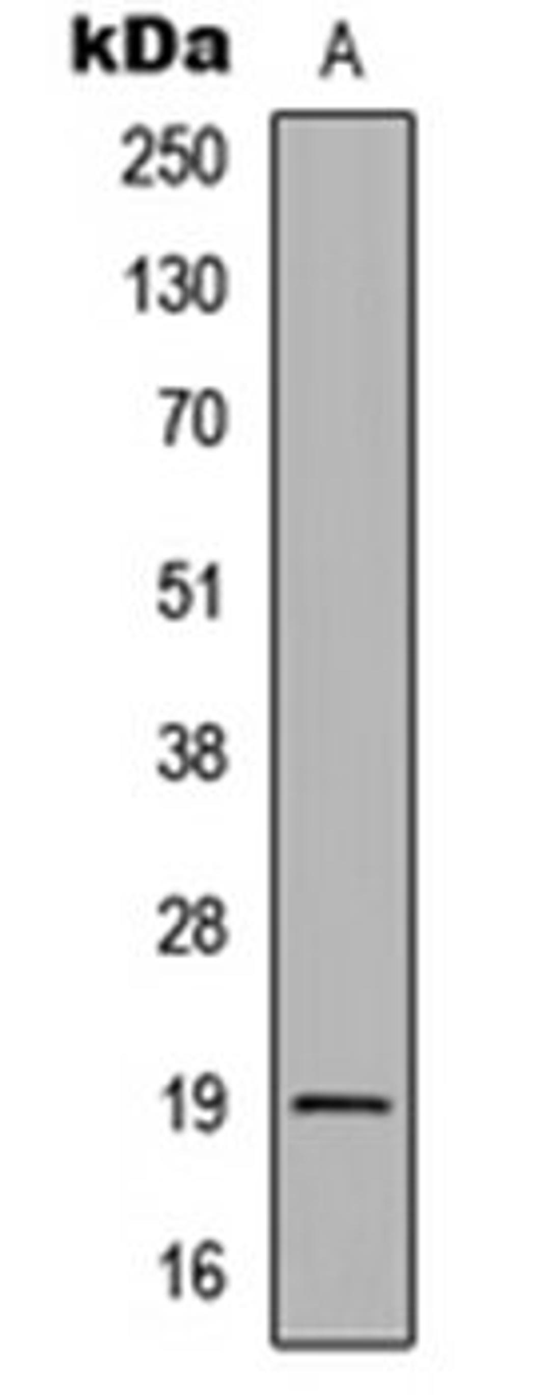 Western blot analysis of HEK293T (Lane 1) whole cell lysates using CD268 antibody