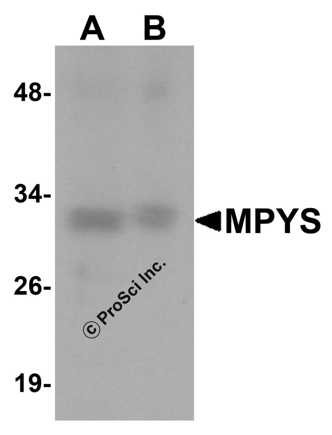 Western blot analysis of MPYS in (A) K562 and (B) Jurkat cell lysate with MPYS antibody at 1 μg/mL.