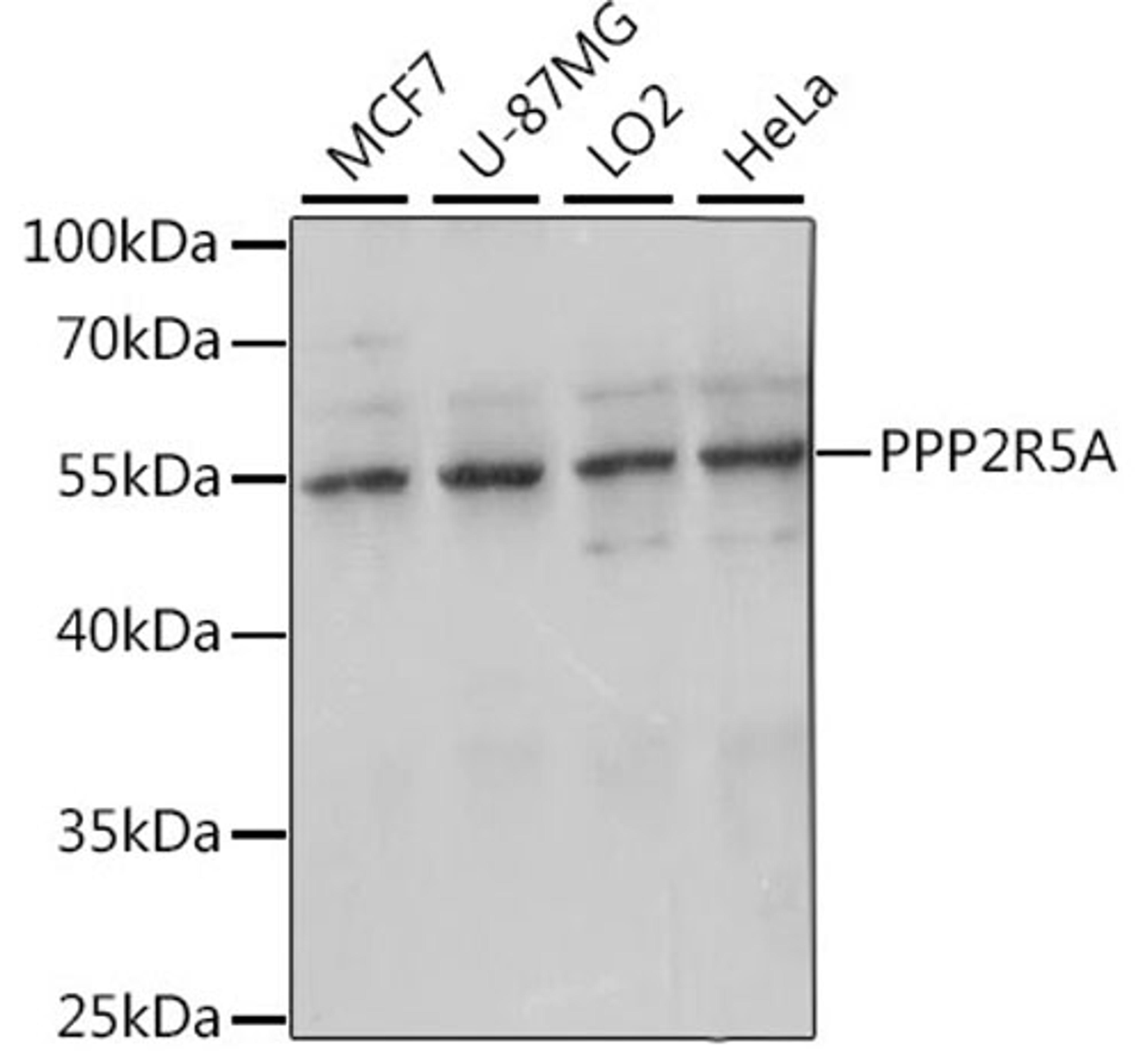 Western blot - PPP2R5A antibody (A15706)