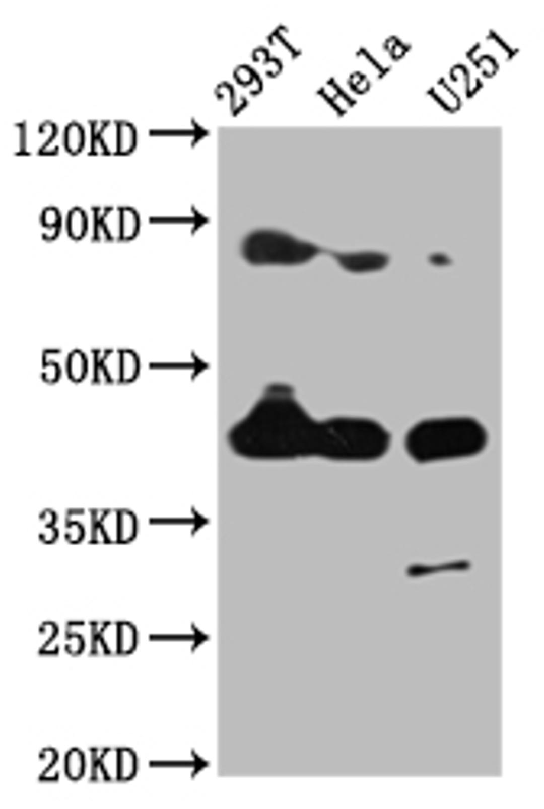 Western Blot. Positive WB detected in: 293T whole cell lysate, Hela whole cell lysate, U251 whole cell lysate. All lanes: MSTN antibody at 4µg/ml. Secondary. Goat polyclonal to rabbit IgG at 1/50000 dilution. Predicted band size: 43 kDa. Observed band size: 43 kDa