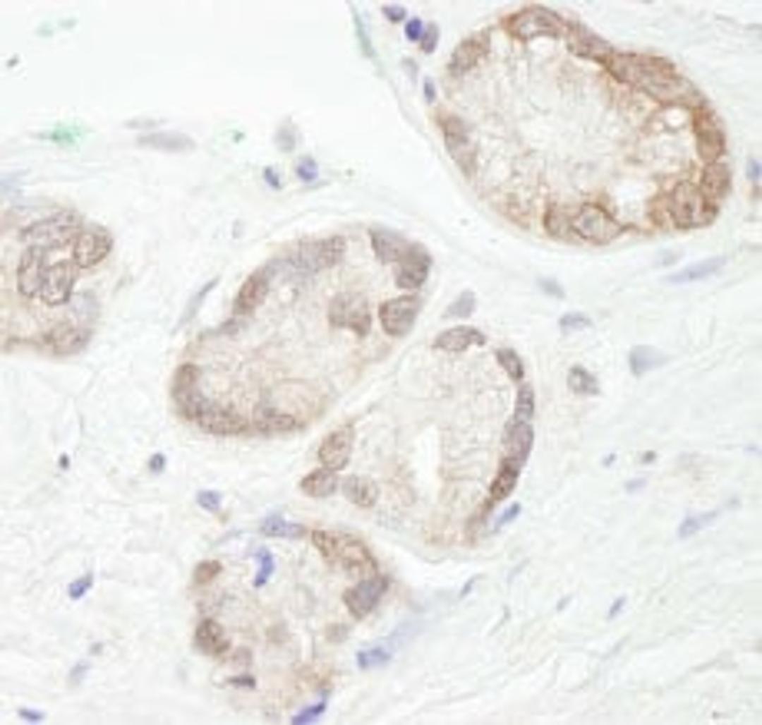 Detection of human UBCH7 by immunohistochemistry.