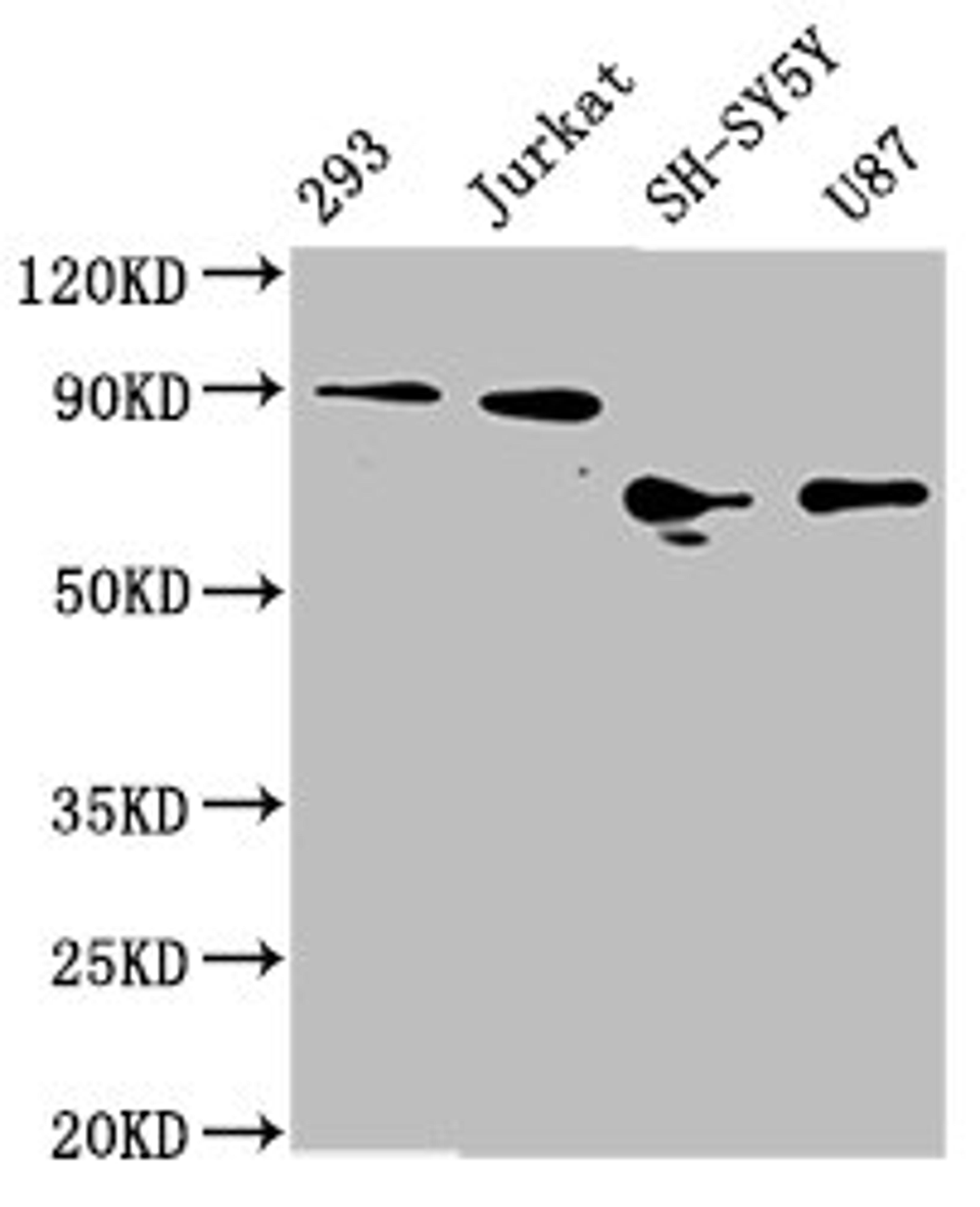 Western Blot. Positive WB detected in: 293 whole cell lysate, Jurkat whole cell lysate, SH-SY5Y whole cell lysate, U87 whole cell lysate. All lanes: FOXO3A antibody at 1.8μg/ml. Secondary. Goat polyclonal to rabbit IgG at 1/50000 dilution. Predicted band size: 72, 49 KDa. Observed band size: 72-90 KDa. 