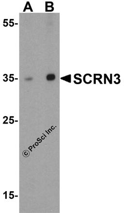 Western blot analysis of SCRN3 in human breast tissue lysate with SCRN3 antibody at (A) 1 and (B) 2 μg/mL.
