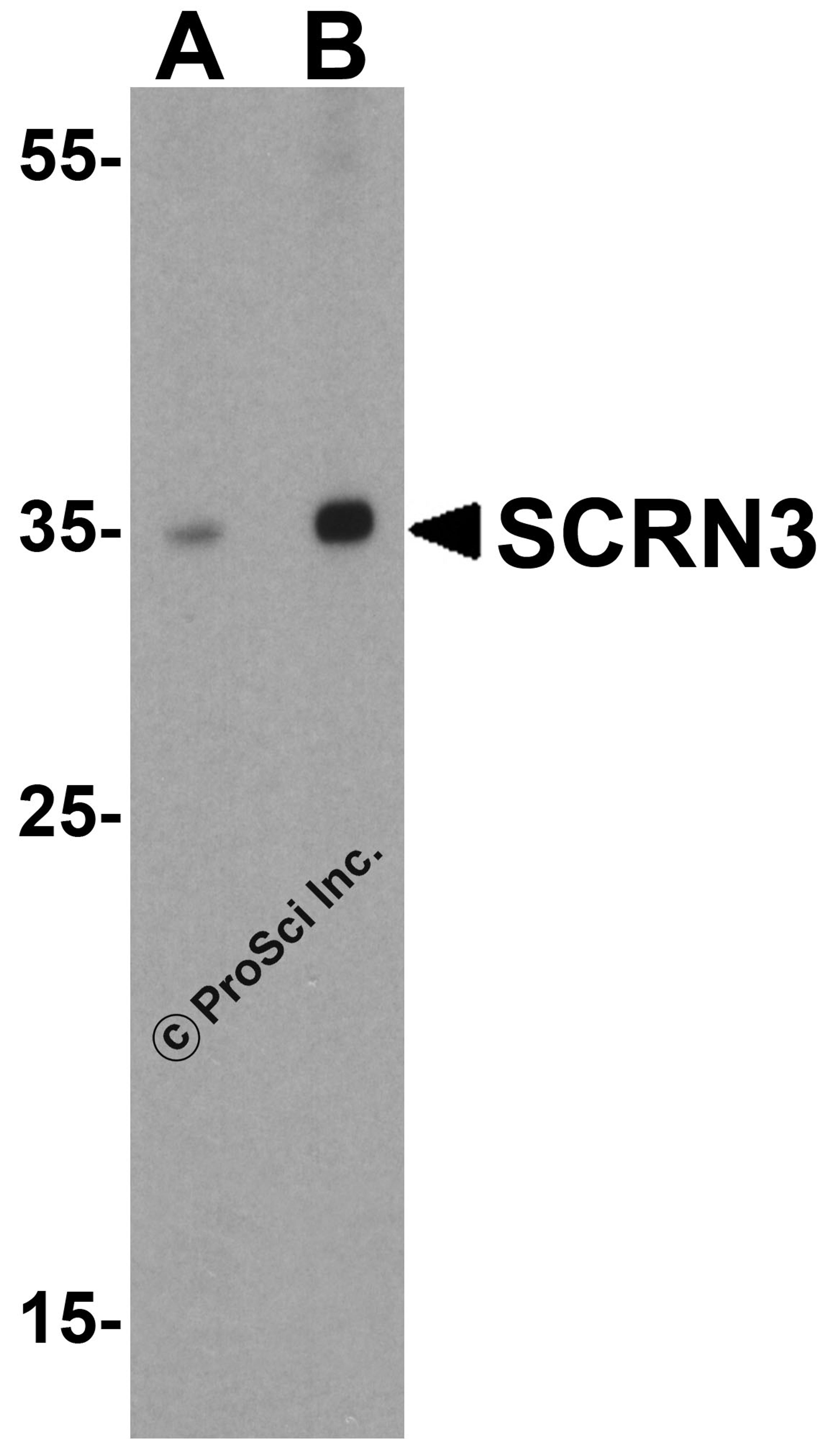 Western blot analysis of SCRN3 in human breast tissue lysate with SCRN3 antibody at (A) 1 and (B) 2 μg/mL.