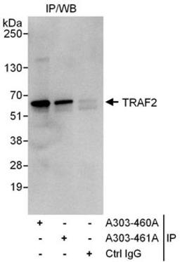 Detection of human TRAF2 by western blot of immunoprecipitates.