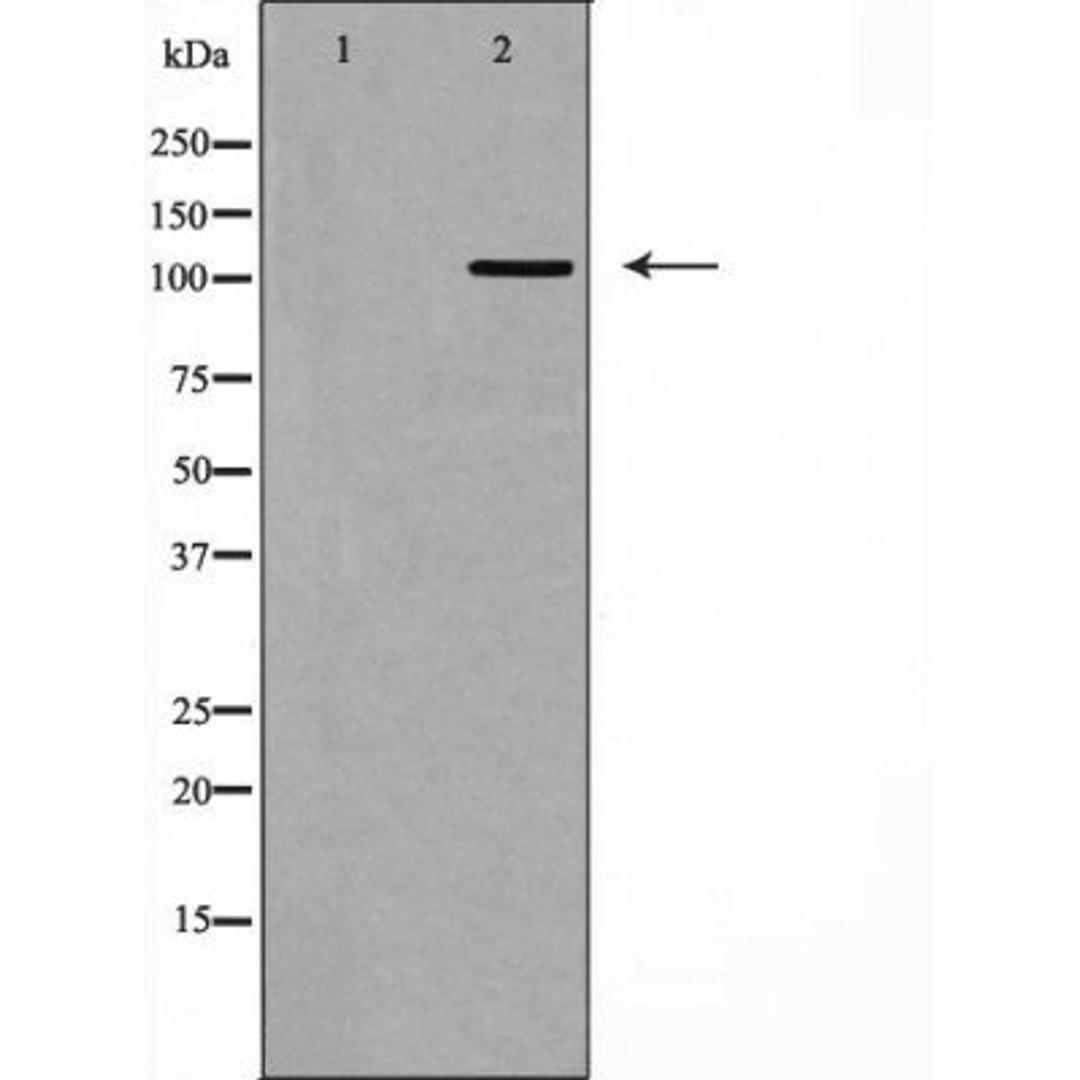 Western blot analysis of HepG2 cell using Integrin Alpha3 (CD49c) antibody