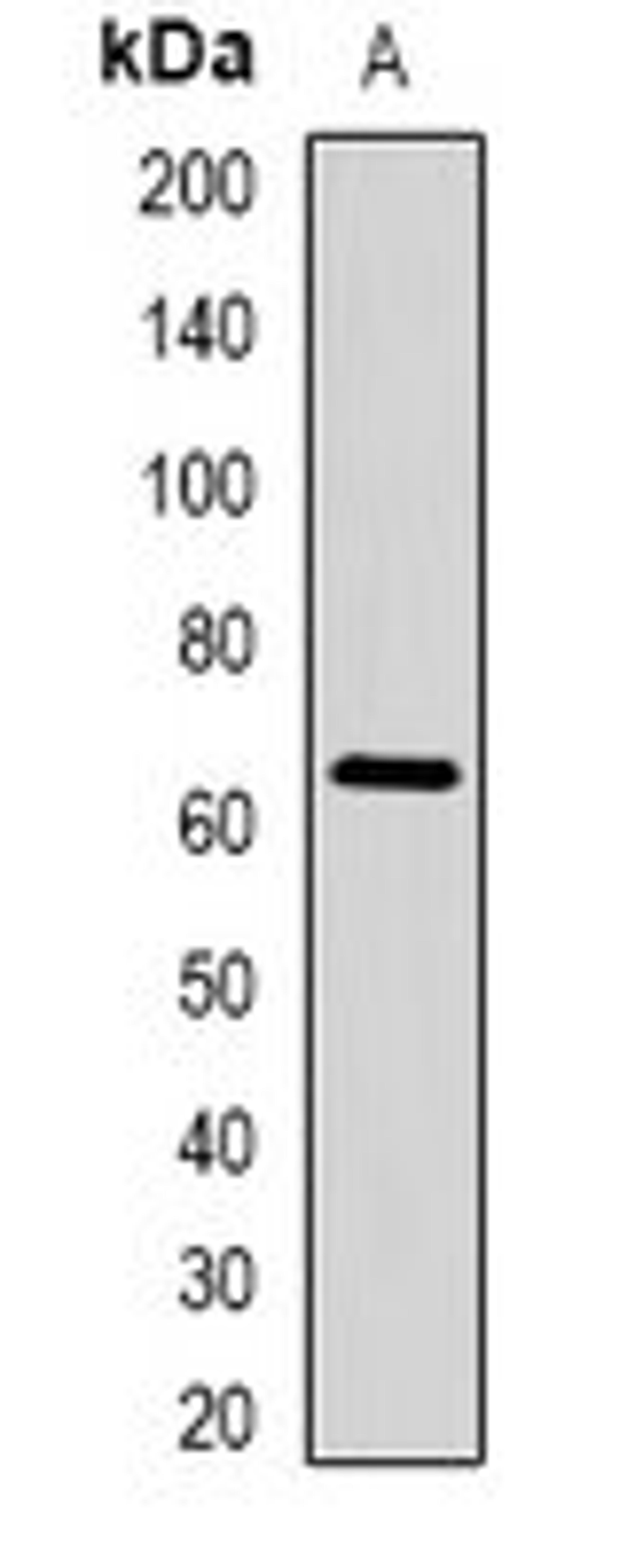 Western blot analysis of HepG2 (Lane1) whole cell lysates using STAU1 antibody