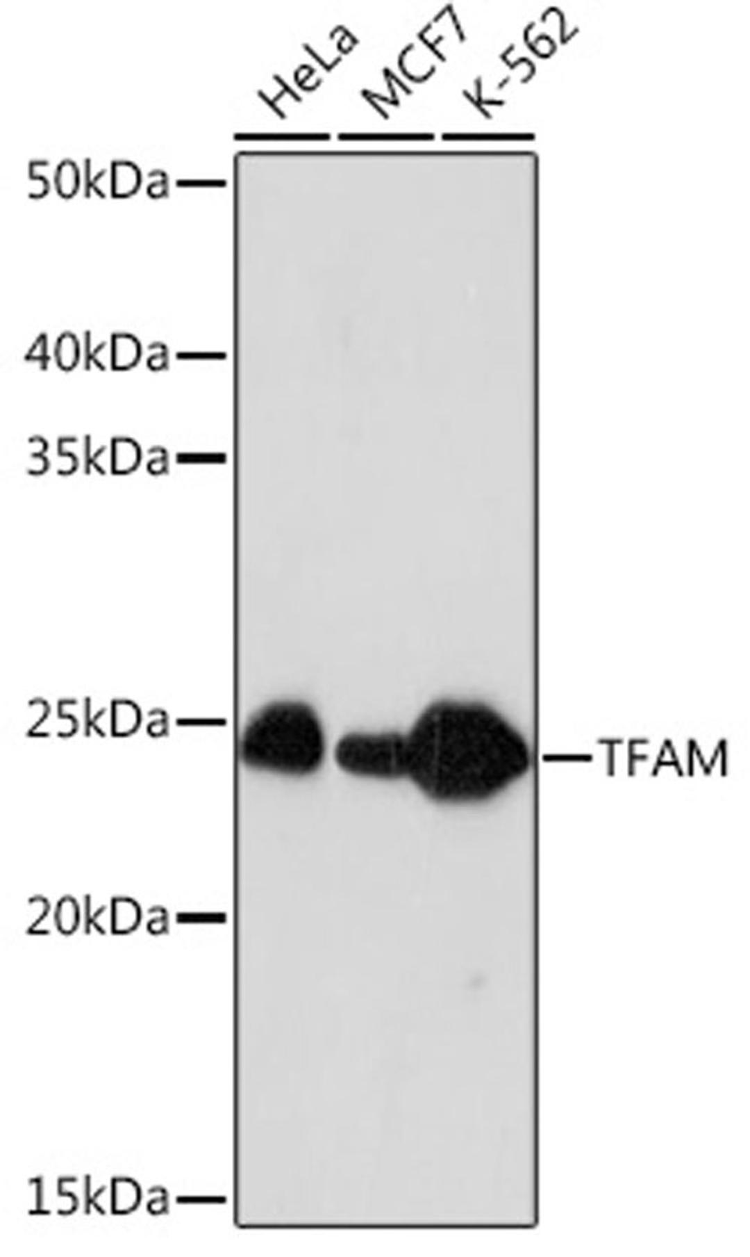 Western blot - TFAM Rabbit mAb (A3173)
